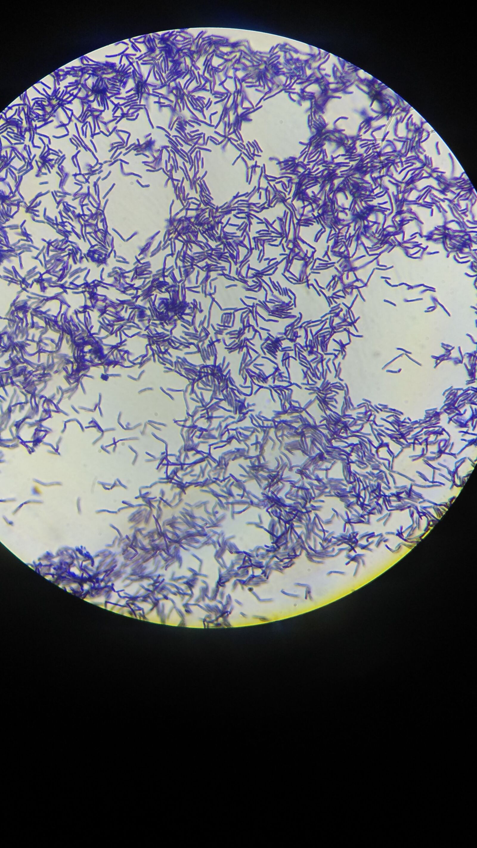 Xiaomi Redmi Note 4 sample photo. Bacteria, lactobacillus, pure culture photography