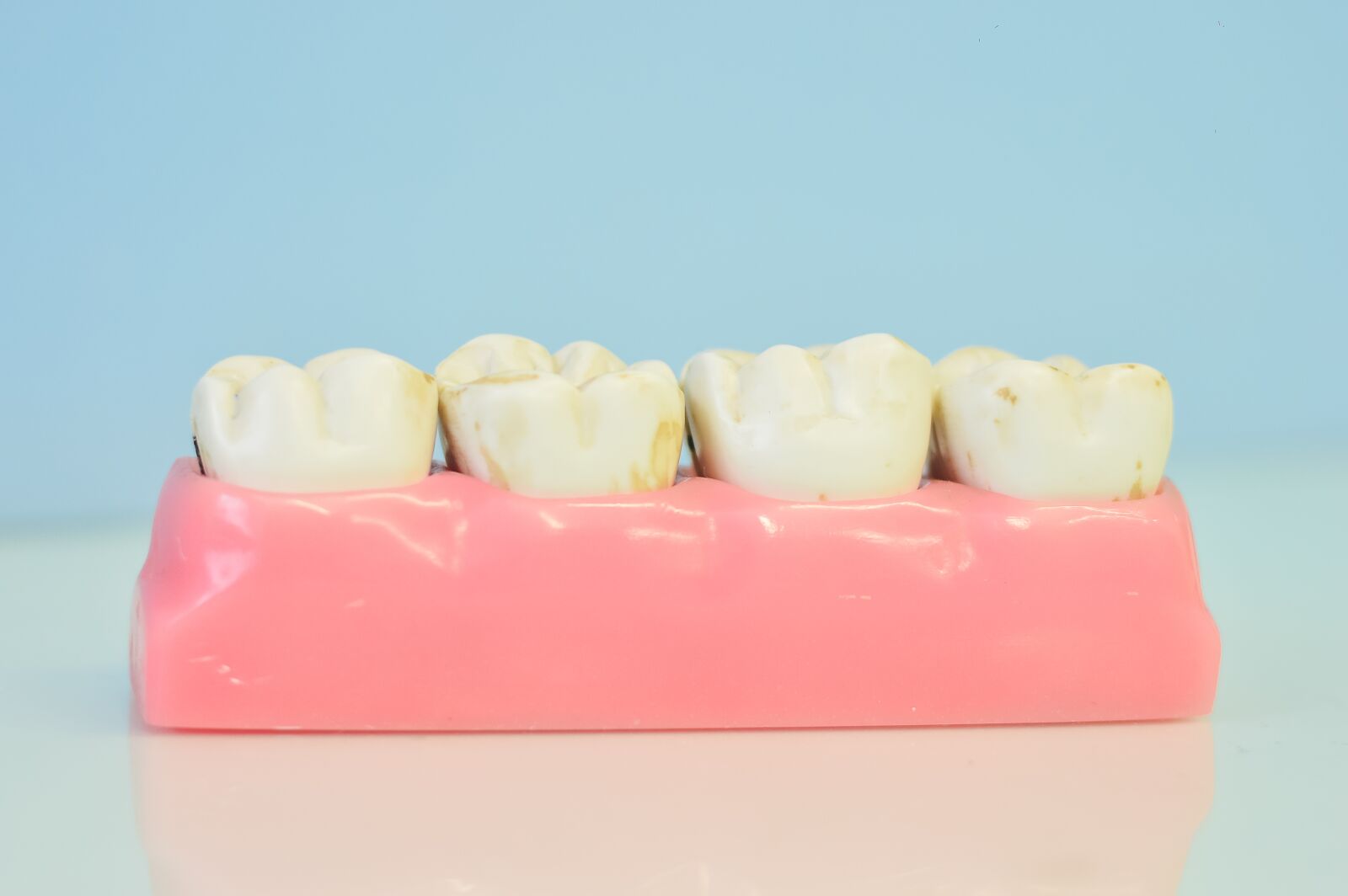 Nikon D3200 sample photo. Macromodelo of teeth, dental photography