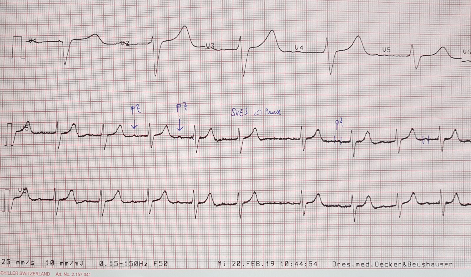 Samsung Galaxy S7 Edge sample photo. Ecg, chart, investigation photography