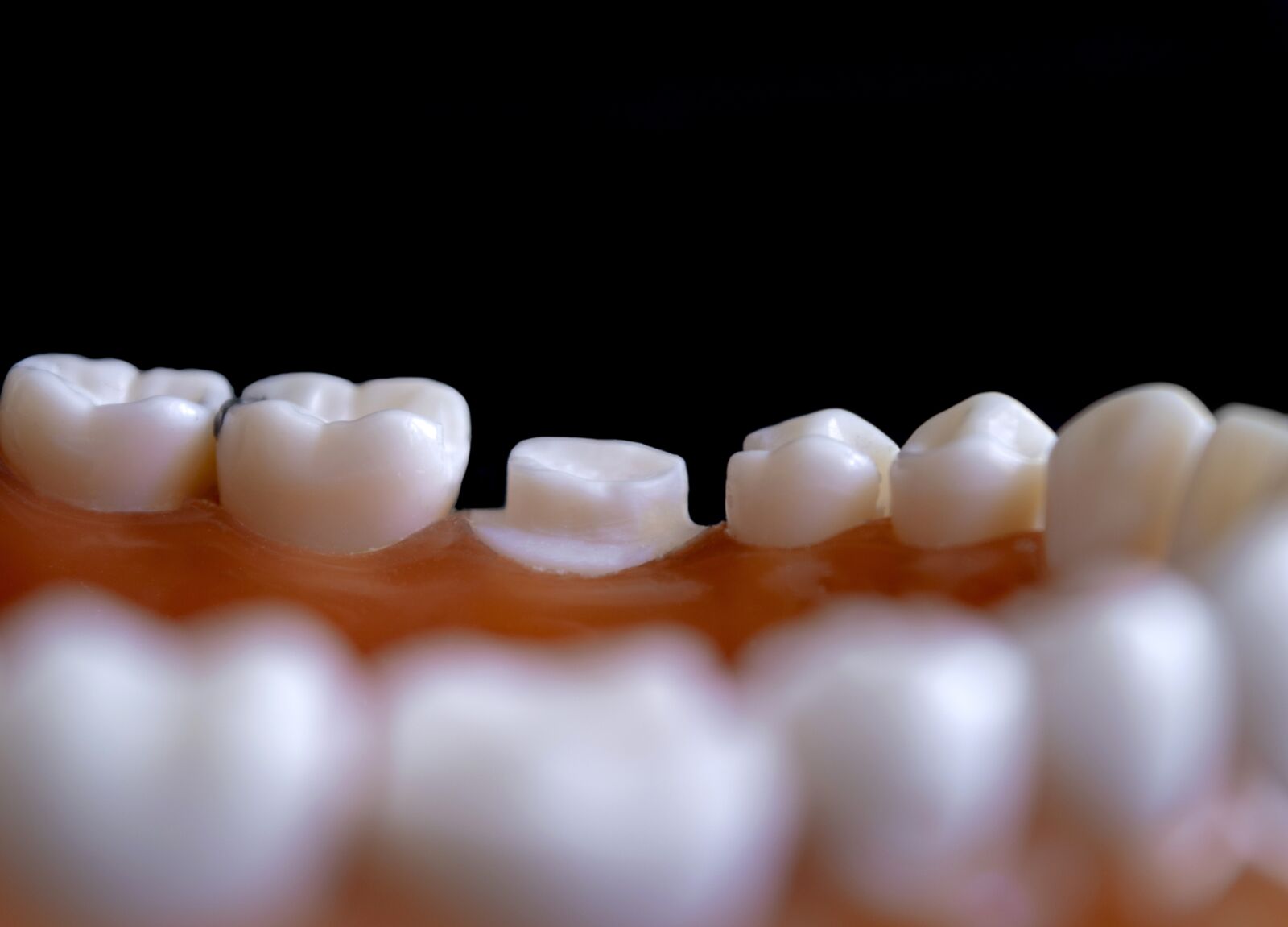 Nikon D3300 sample photo. Dentistry, tooth, hygiene photography