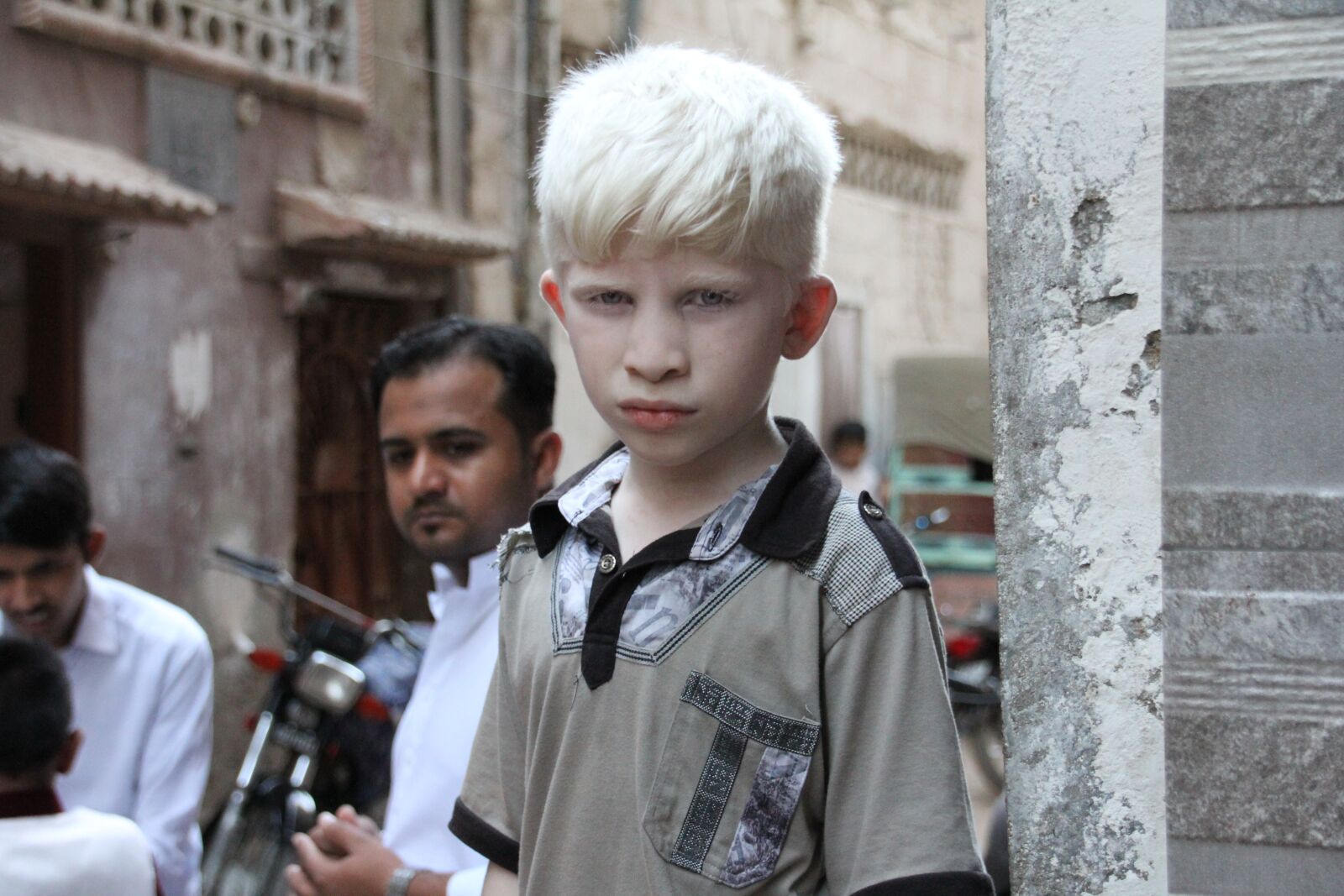 Canon EOS 60D sample photo. Albino, white, asian photography