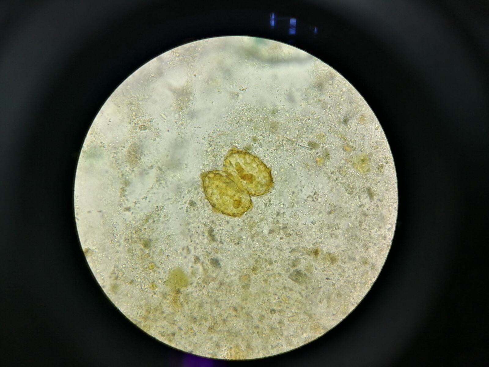 HUAWEI JKM-LX2 sample photo. Egg, microscopy, parasite photography