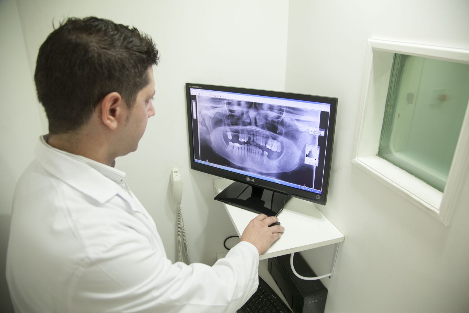 Canon EOS 5D Mark II sample photo. X-ray of the jaw photography