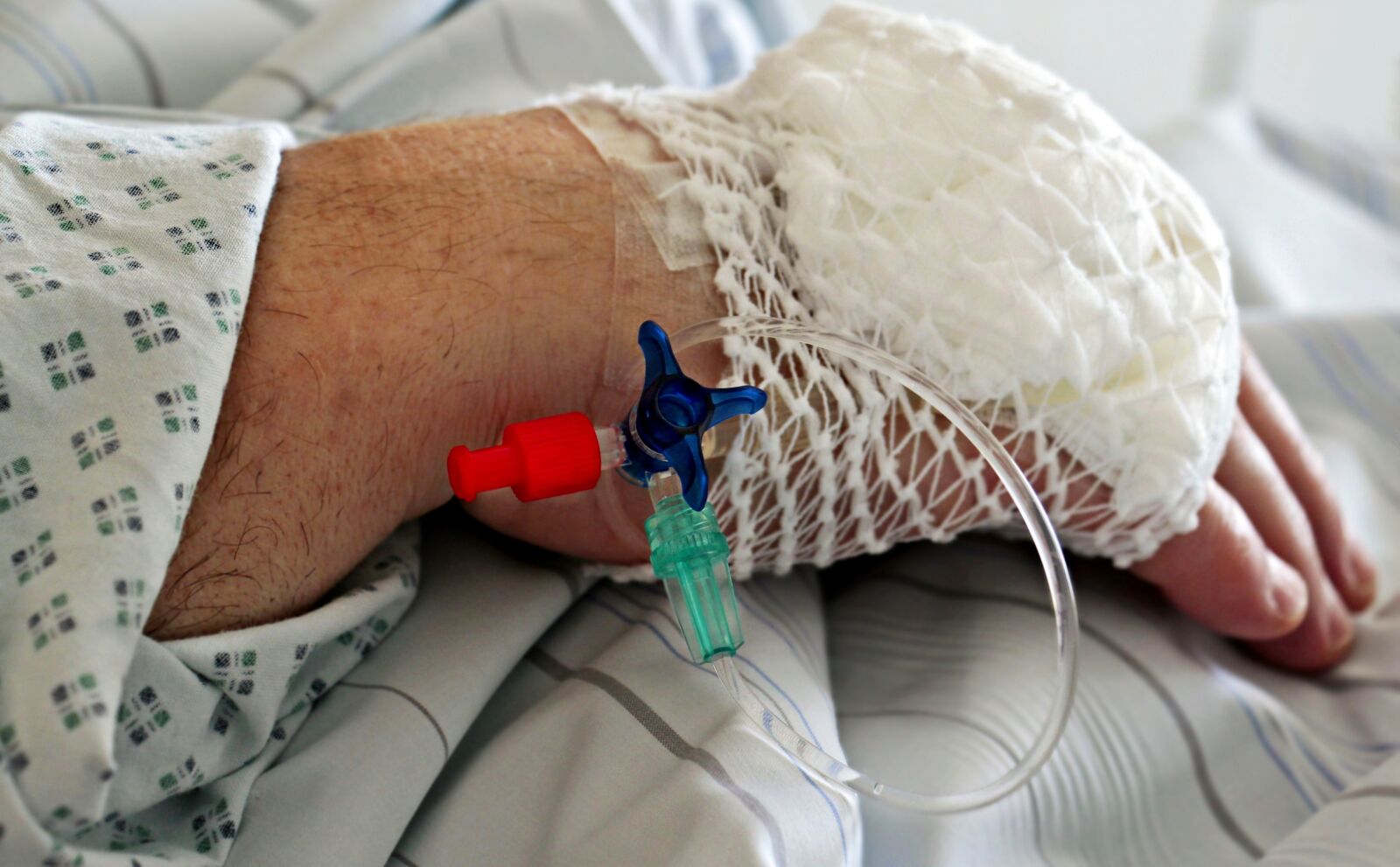 Canon EOS 100D (EOS Rebel SL1 / EOS Kiss X7) sample photo. Medical, access, venous access photography