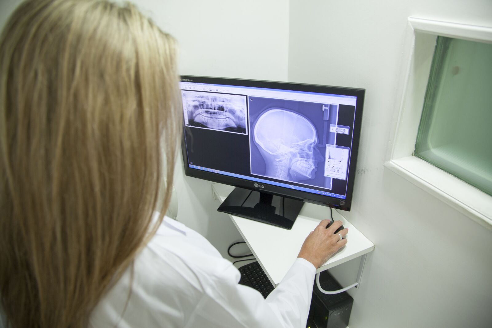Canon EOS 5D Mark II sample photo. X-ray of the jaw photography