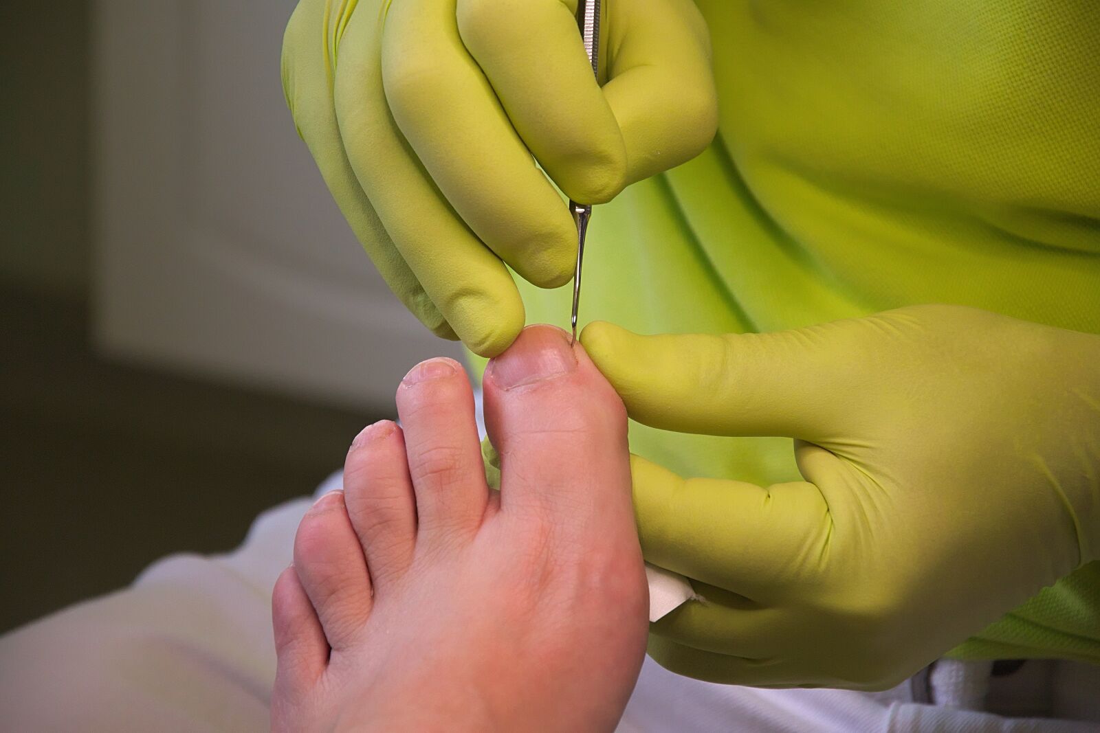 Nikon D3300 sample photo. Foot care, podiatry, treatment photography