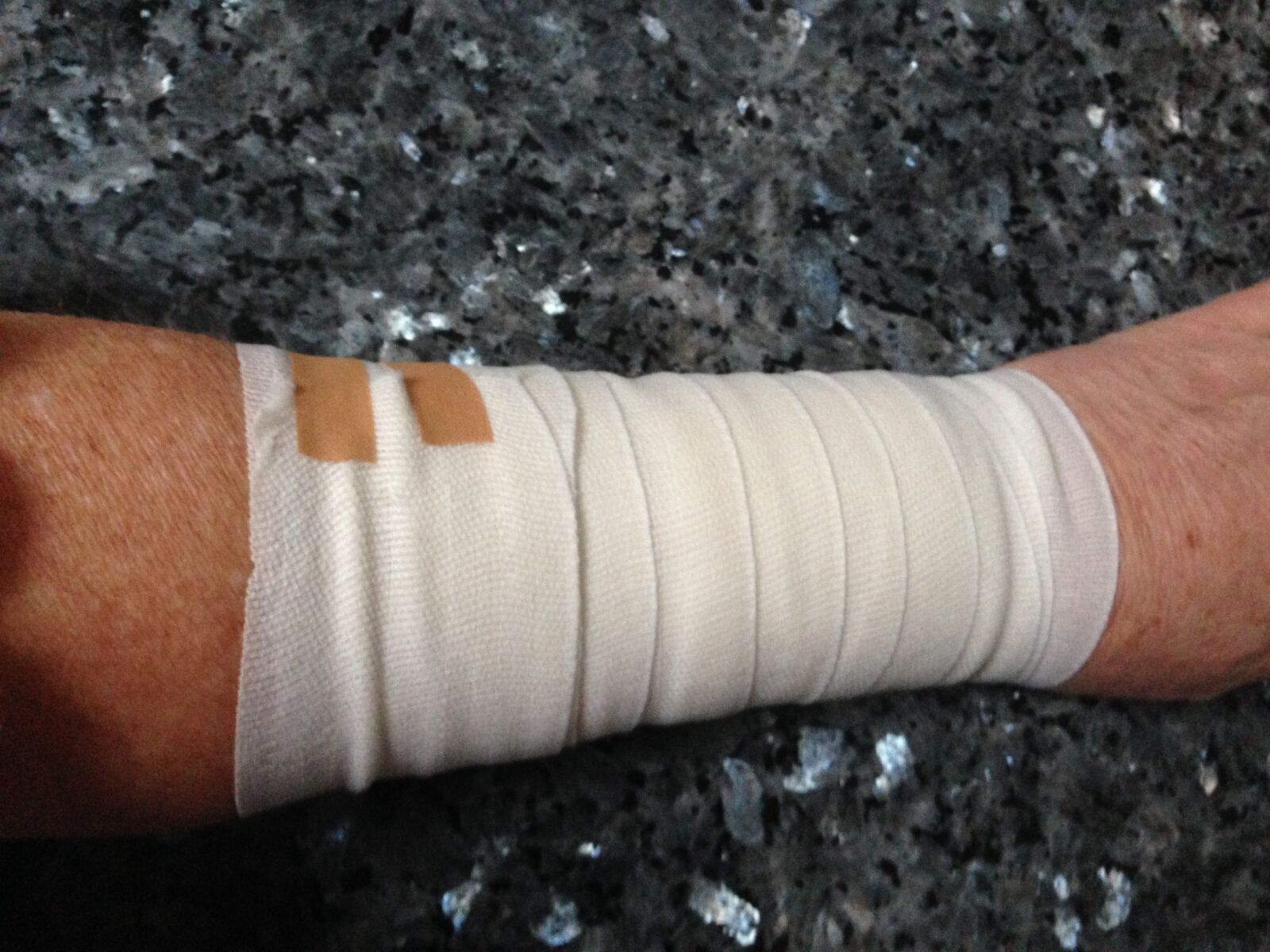 iPhone 5 back camera 4.12mm f/2.4 sample photo. Bandage, snelverband, an ideal photography