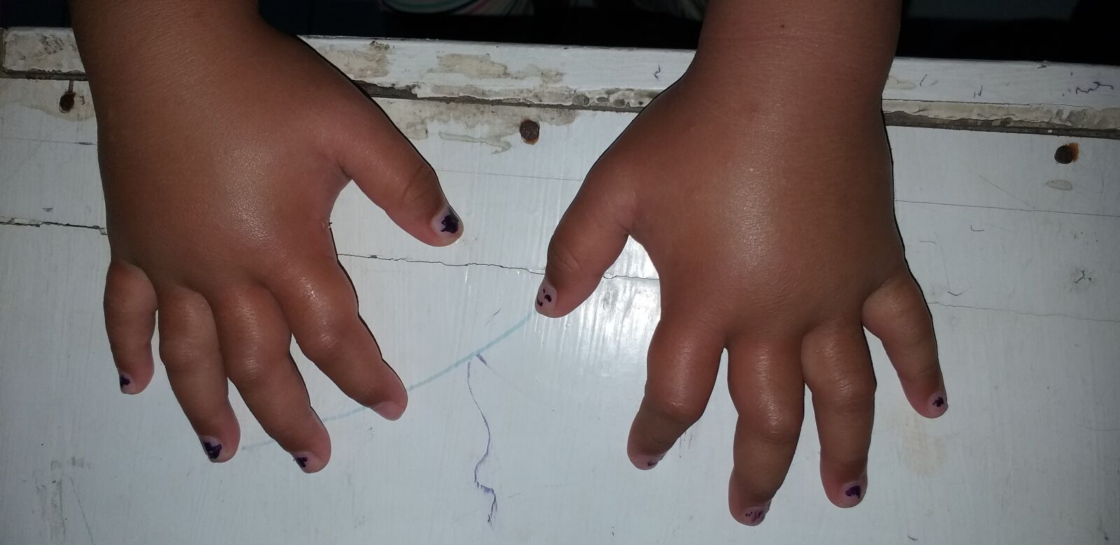 Samsung Galaxy A6+ sample photo. Hand, palm, palmar photography