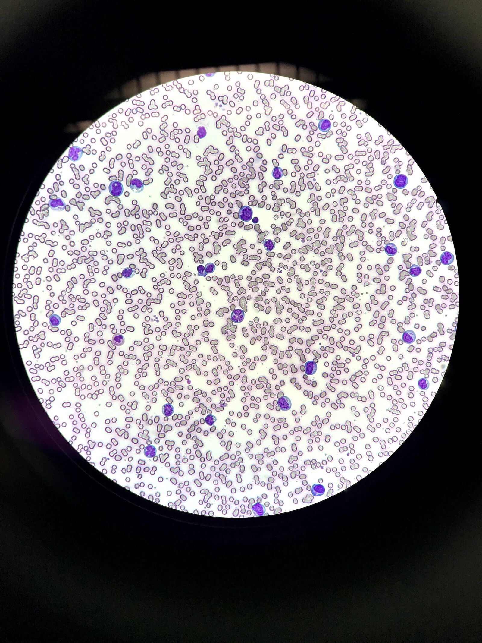 iPhone 7 back camera 3.99mm f/1.8 sample photo. Cells, staining, stained photography