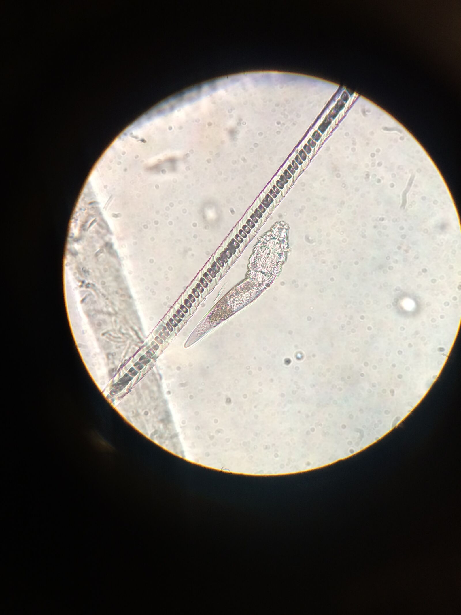 Apple iPhone 5s sample photo. Microscope, mites, demodex photography