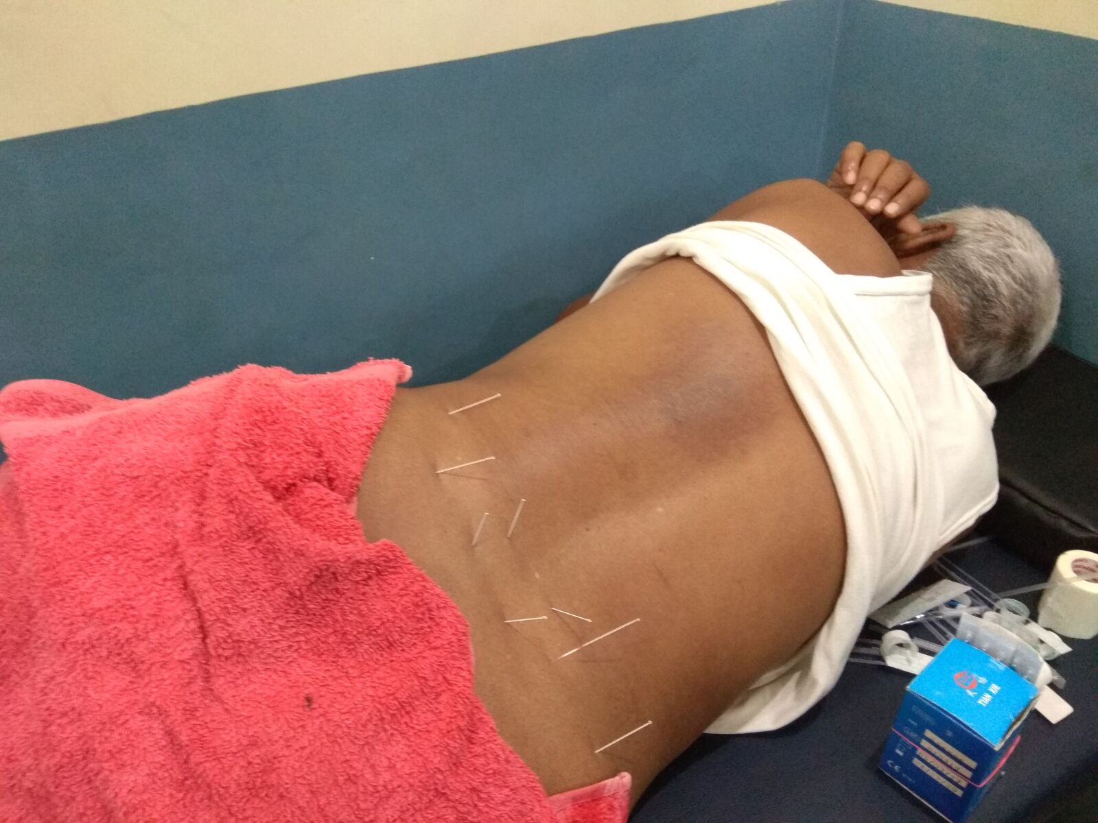 Xiaomi Redmi Note 4 sample photo. Dryneedling, physio, pain photography