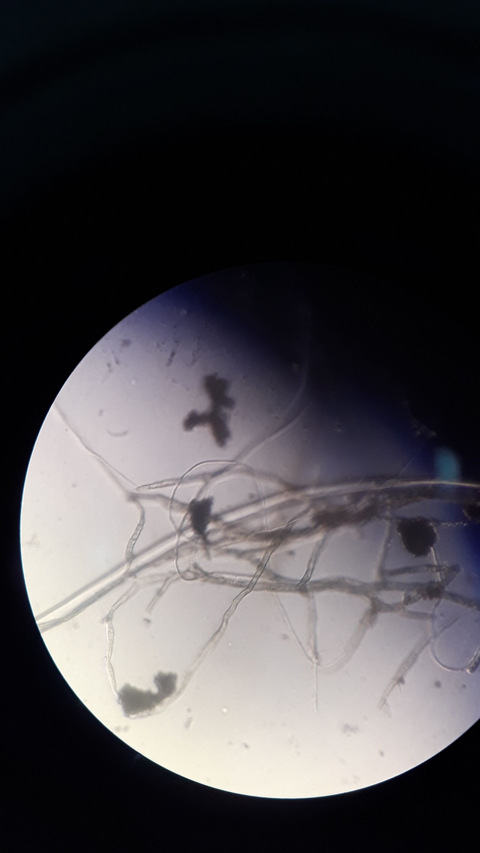 Samsung Galaxy J5 Prime sample photo. Parasitos, intestinal, microscopio photography