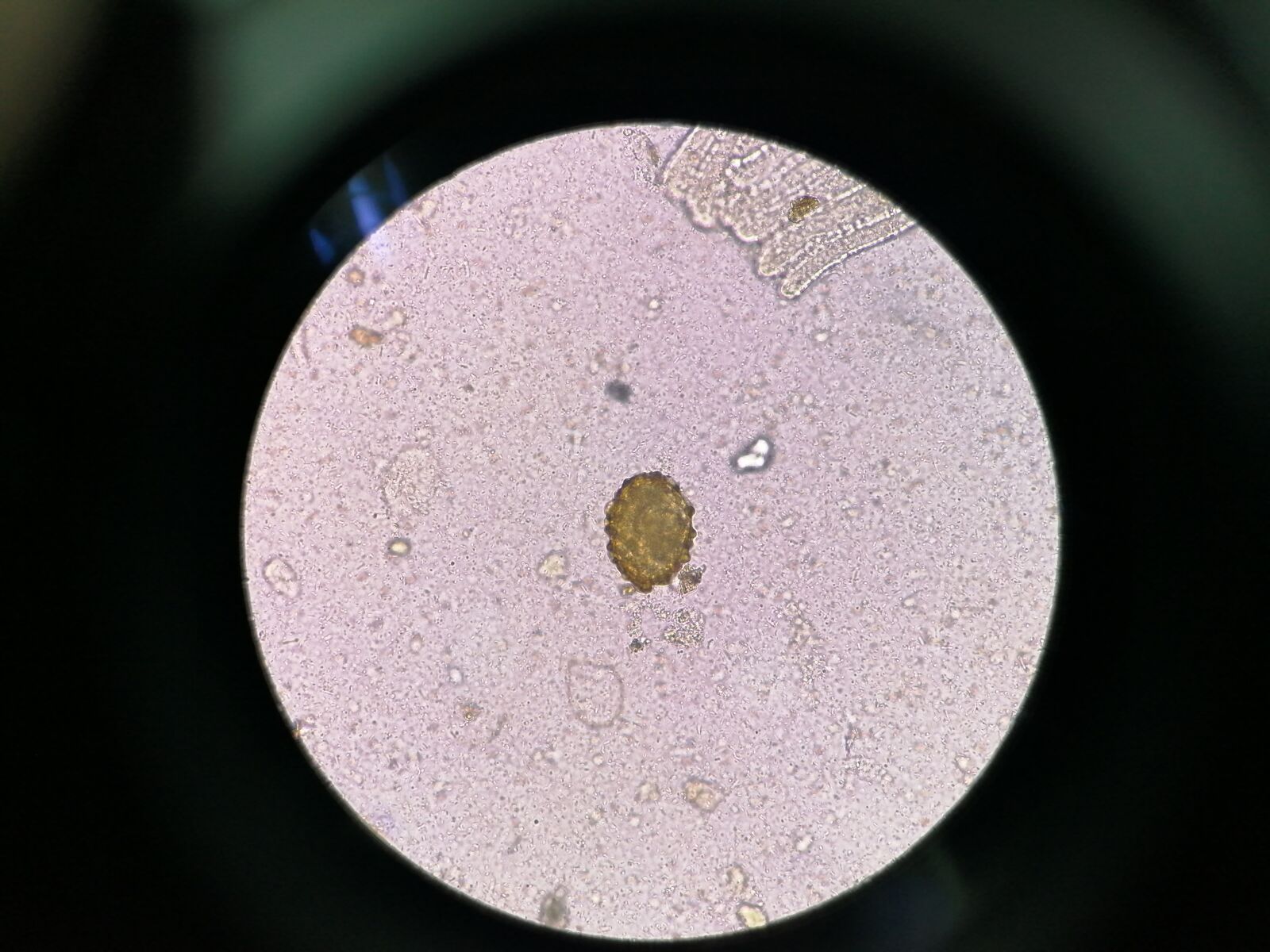 HUAWEI JKM-LX2 sample photo. Egg, microscopy, parasite photography