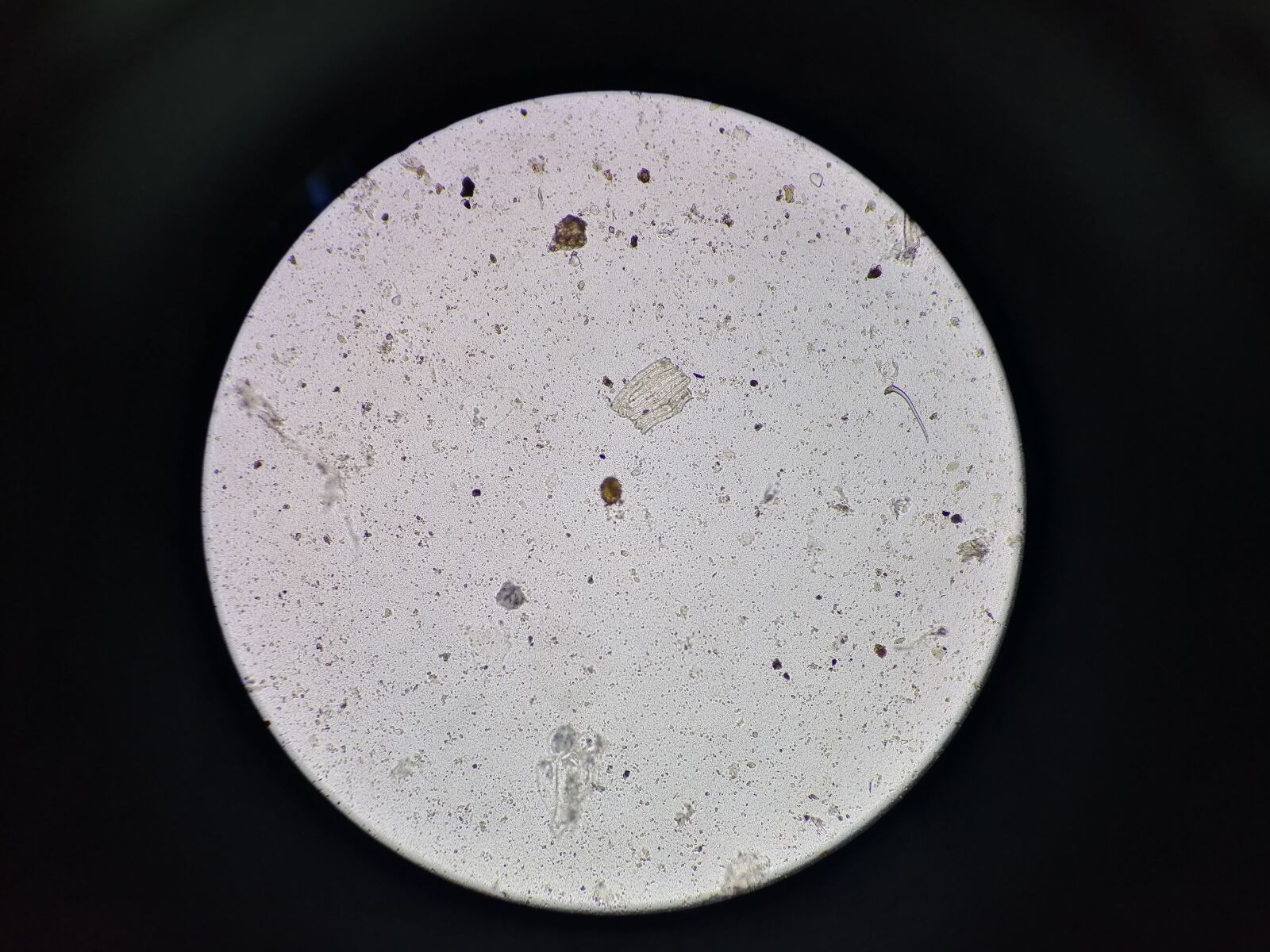 HUAWEI JKM-LX2 sample photo. Eggs, microscopy, parasite photography