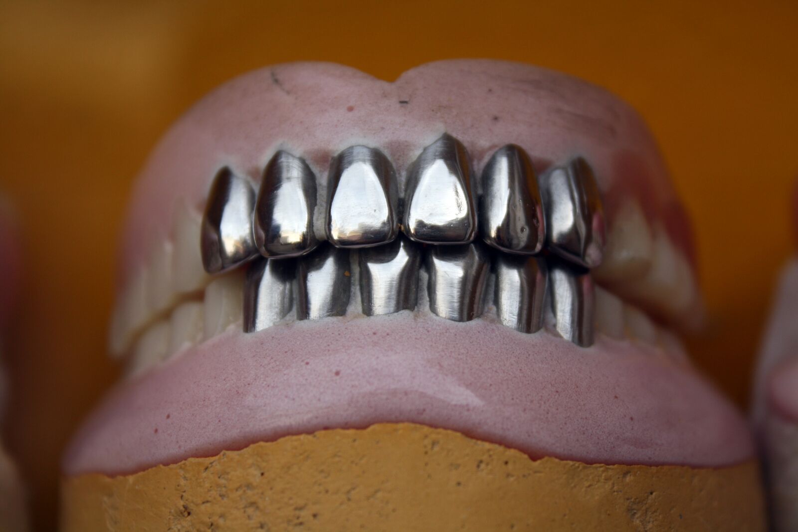 Canon EOS 1000D (EOS Digital Rebel XS / EOS Kiss F) sample photo. Metal teeth, dental, denture photography