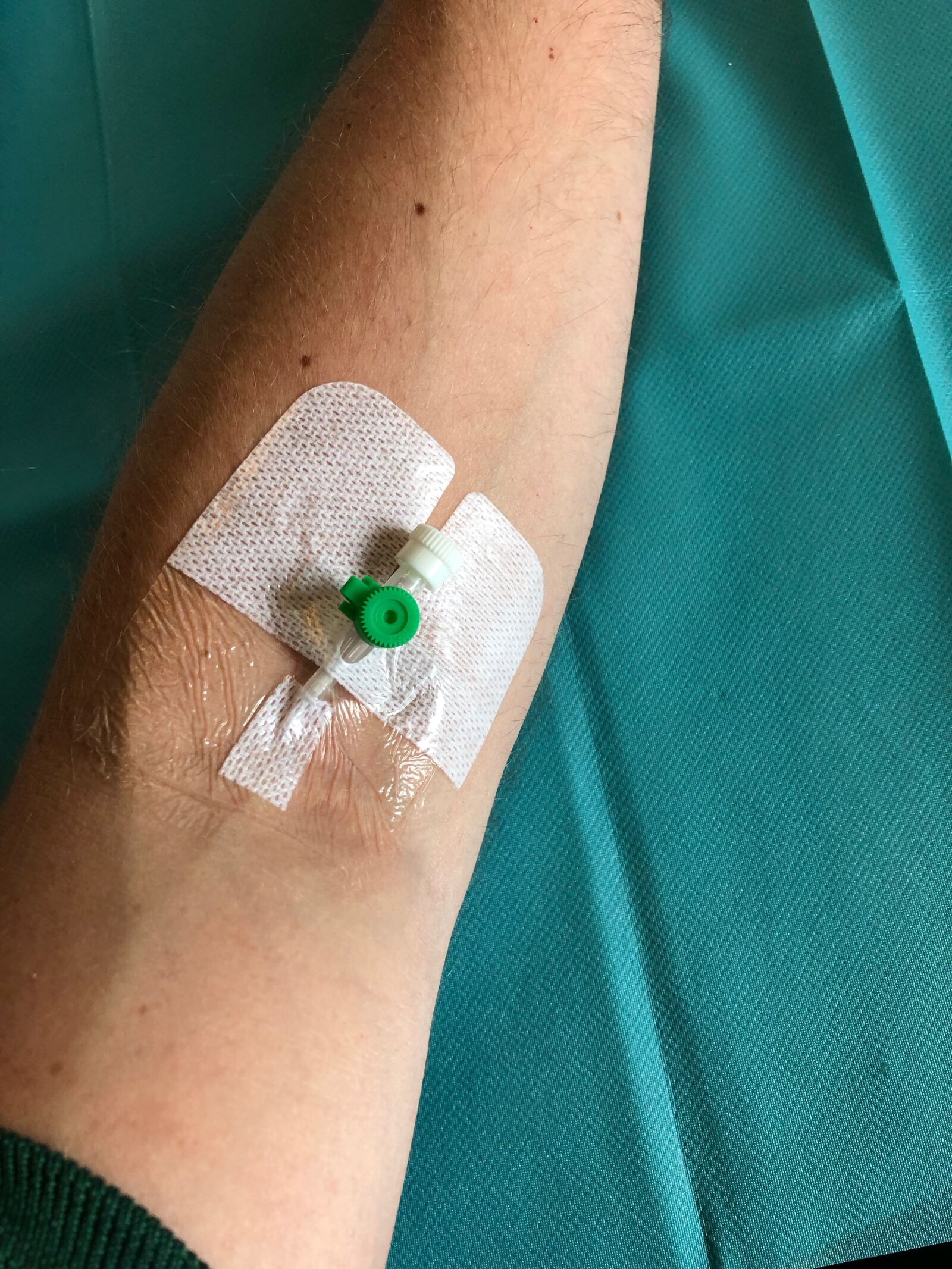 iPhone 8 back camera 3.99mm f/1.8 sample photo. Peripheral venous catheter, pvc photography
