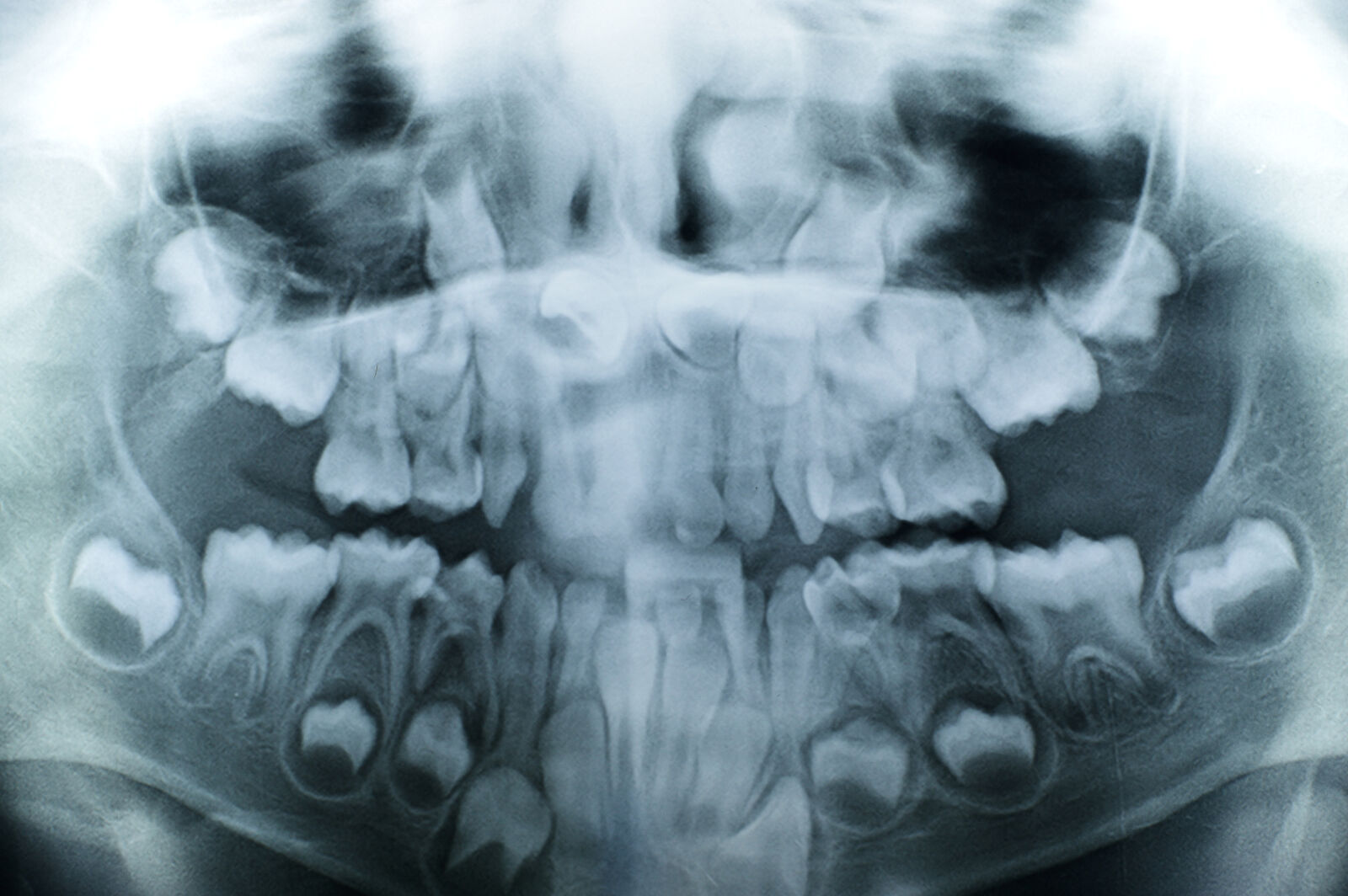 Nikon D3200 sample photo. Anatomy, bone, cranium, dental photography