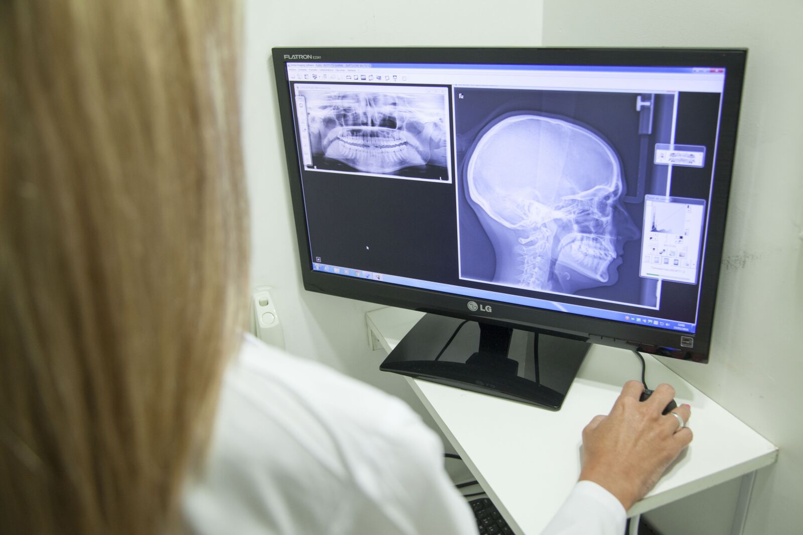 Canon EOS 5D Mark II sample photo. X-ray of the jaw photography