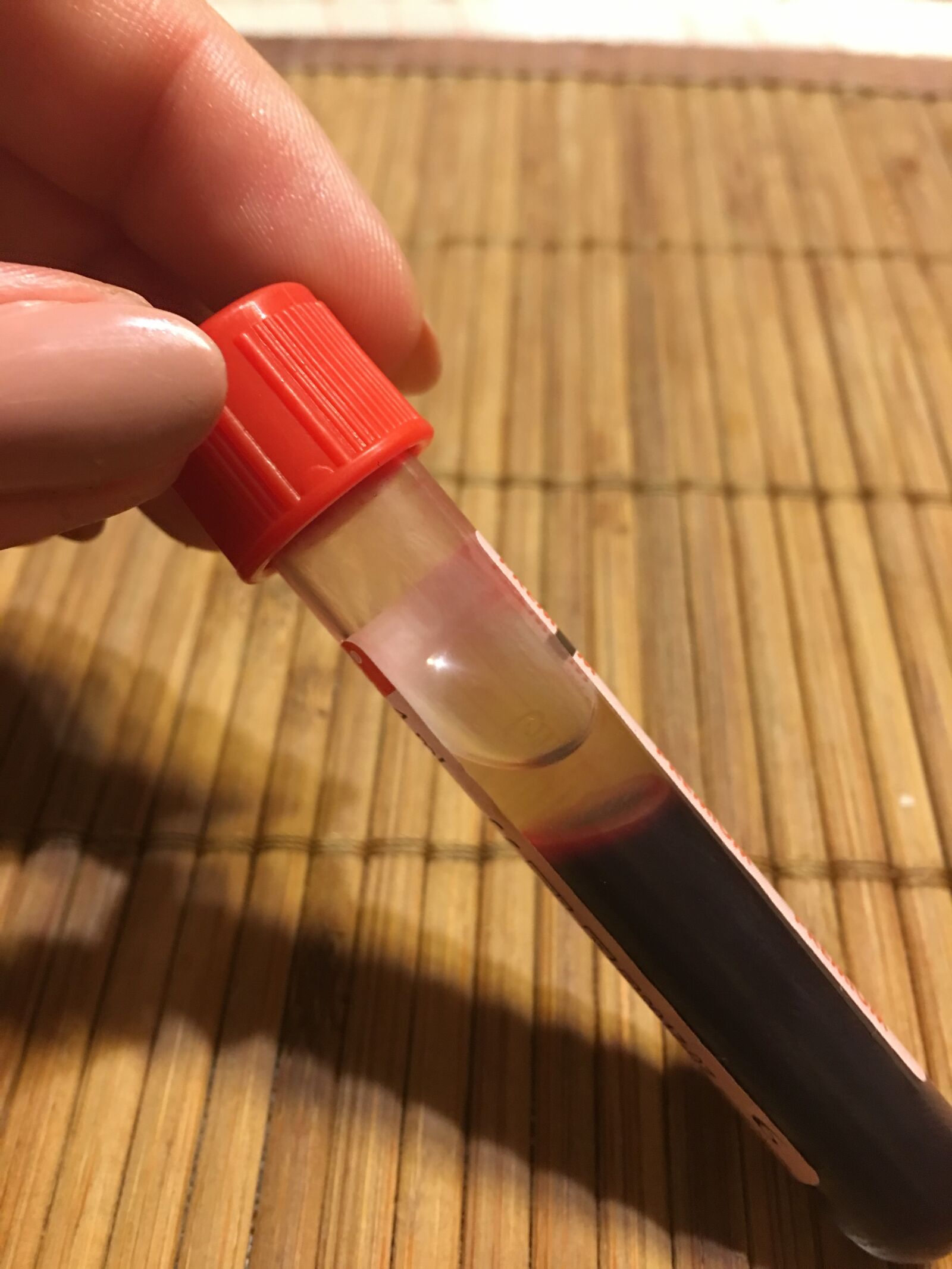 Apple iPhone 6s Plus sample photo. Blood, tube, laboratory photography
