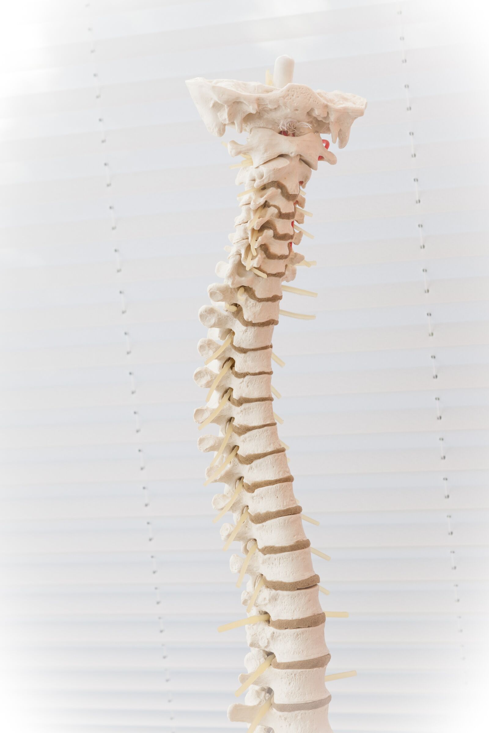 Canon EOS 5D Mark II sample photo. Spine, disc, move photography