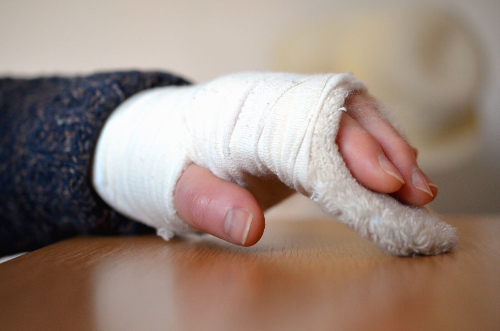 Nikon D5100 sample photo. Hand, finger, broken, plaster photography