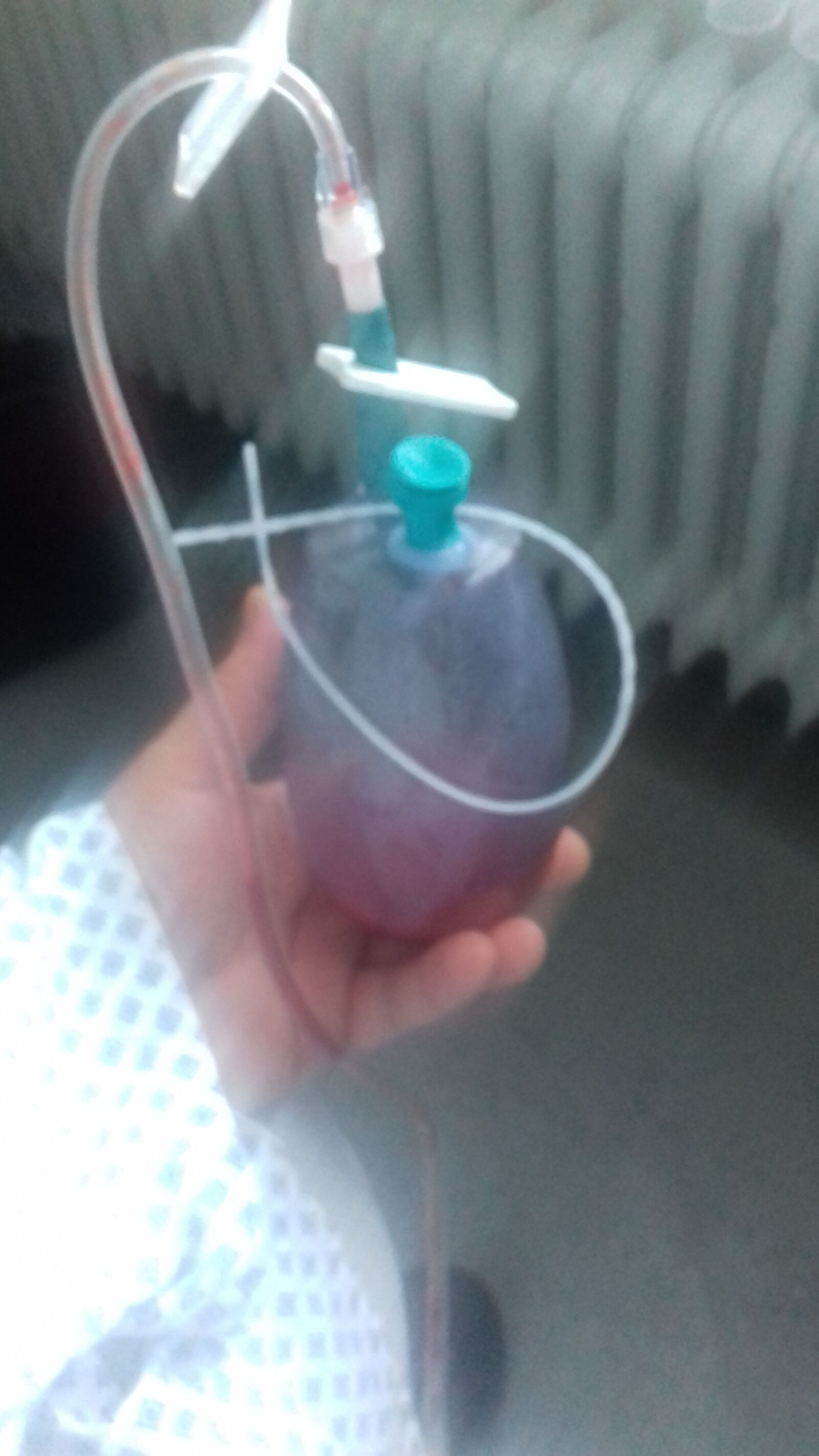 Samsung Galaxy J3(2016) sample photo. Bottle, blood, hand photography