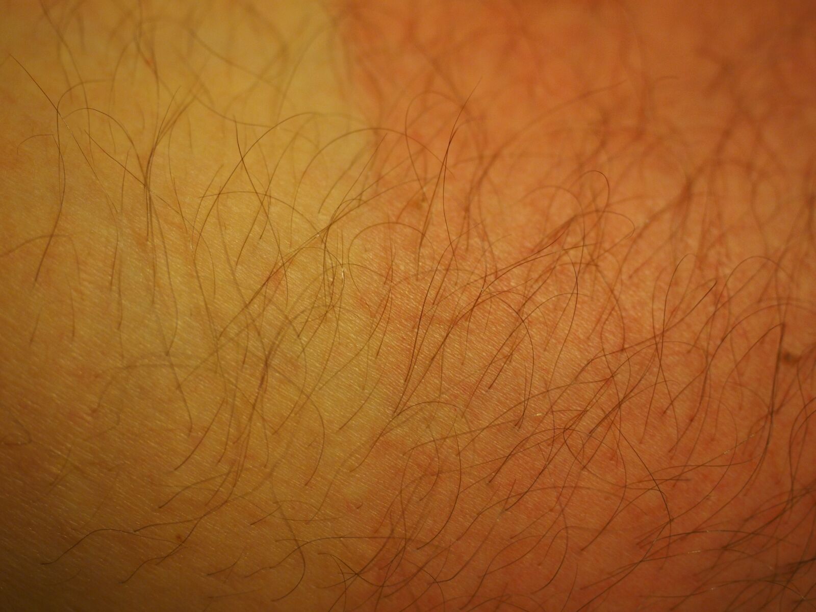 Olympus OM-D E-M1 + Olympus M.Zuiko Digital ED 12-40mm F2.8 Pro sample photo. Sunburn, skin, hair photography