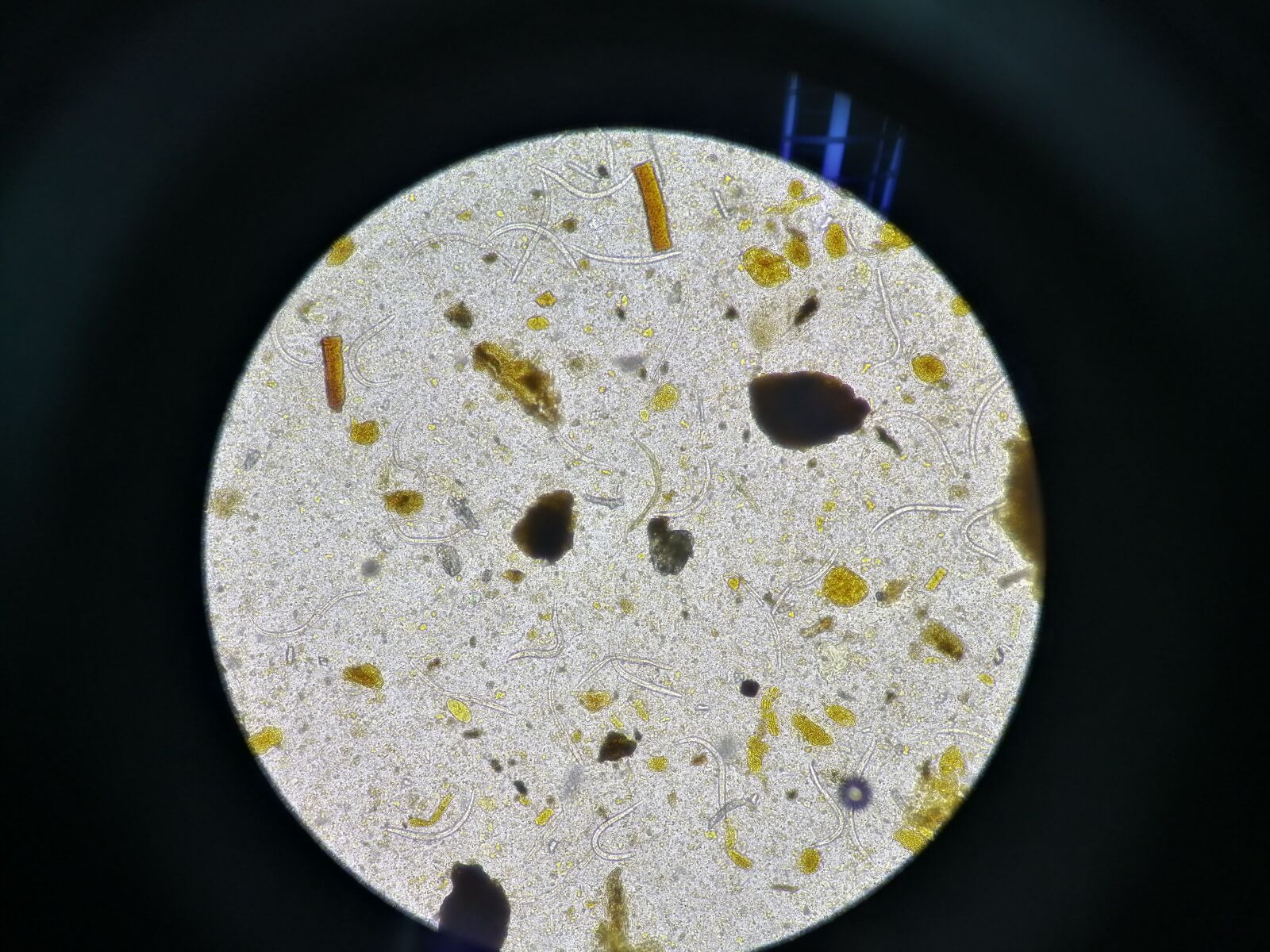 HUAWEI JKM-LX2 sample photo. Egg, microscopy, parasite photography