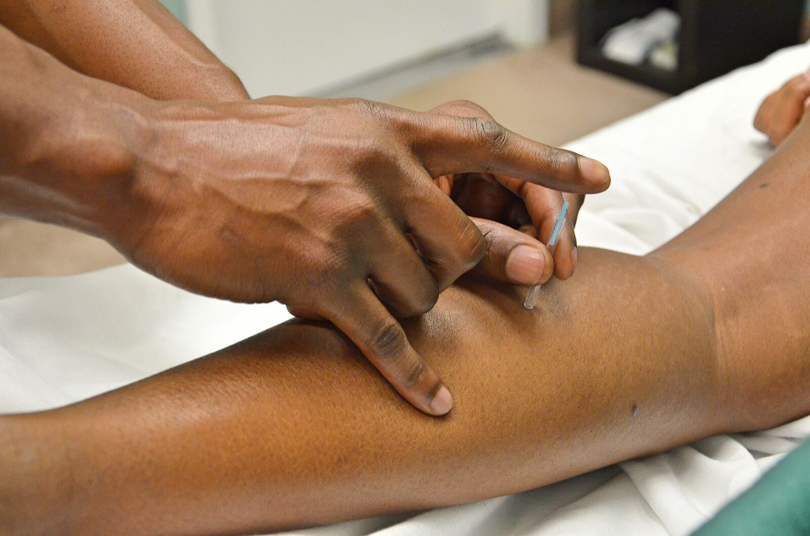 Nikon D7000 sample photo. Acupuncture, asian medicine, needles photography