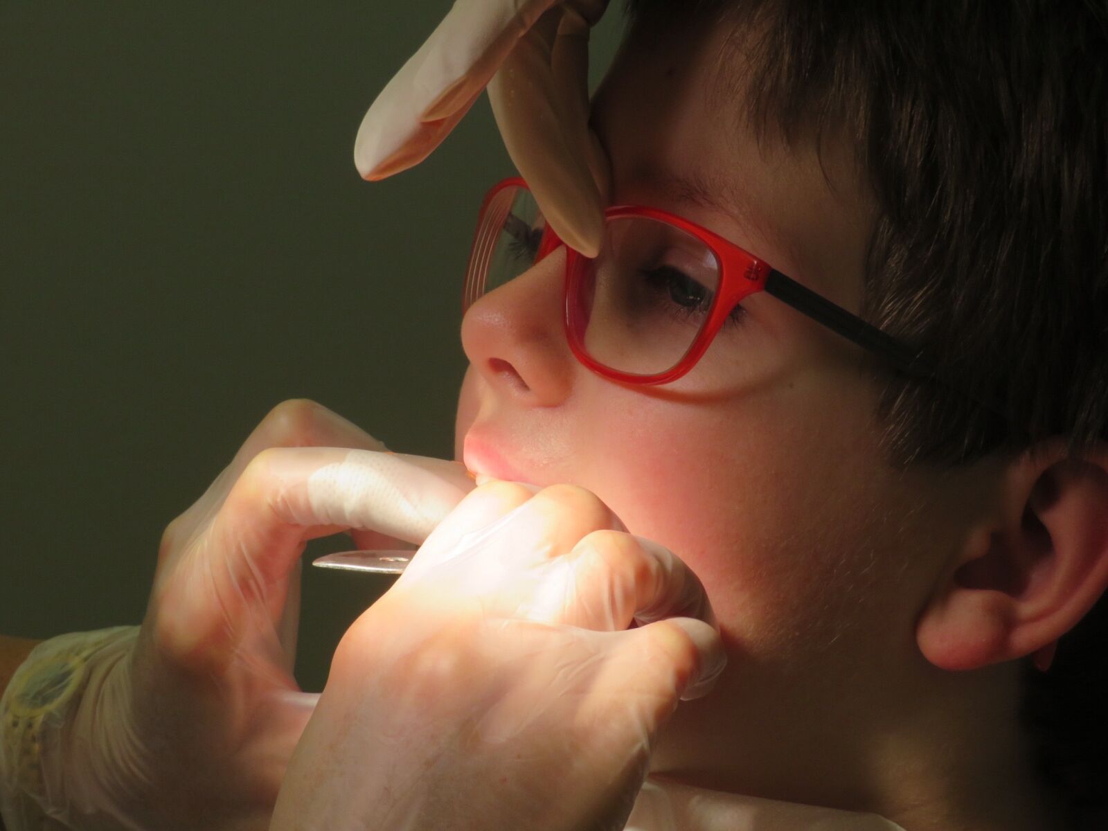 Canon PowerShot SX720 HS sample photo. Dentist, dental braces, tooth photography