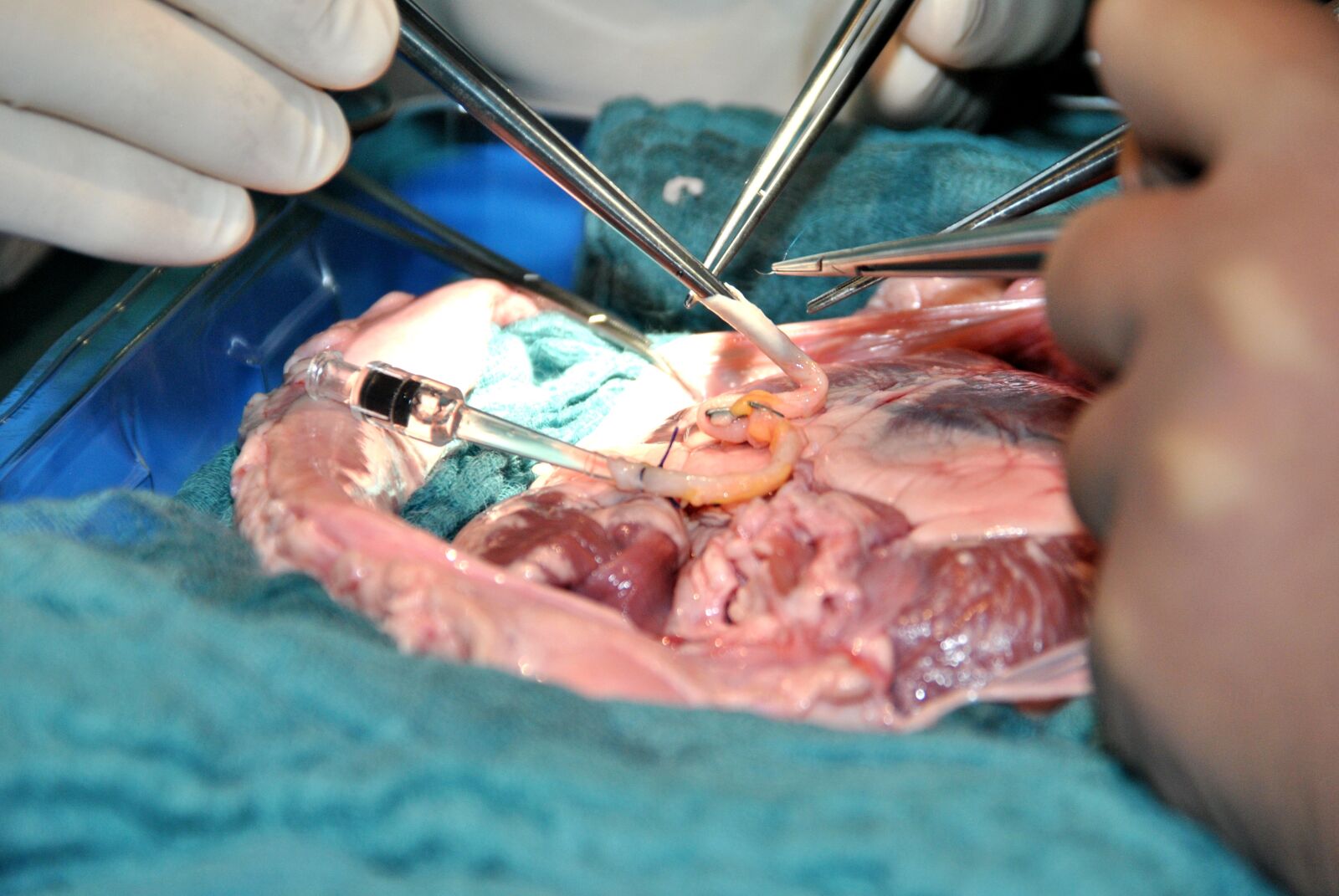 Nikon D3000 sample photo. Op, operation, doctor photography
