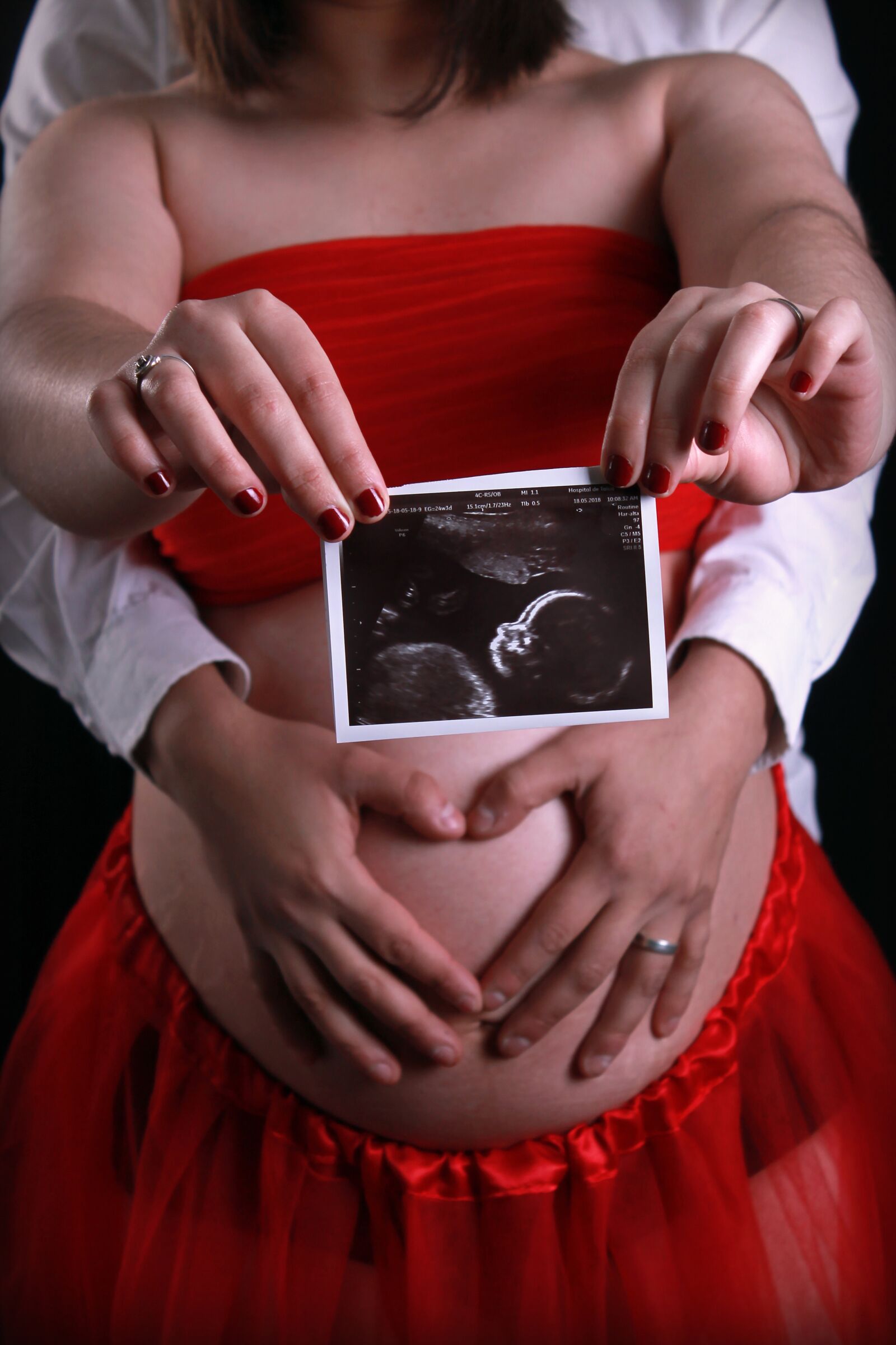 Canon EOS 1100D (EOS Rebel T3 / EOS Kiss X50) sample photo. Pregnancy, ultrasound, pregnant photography