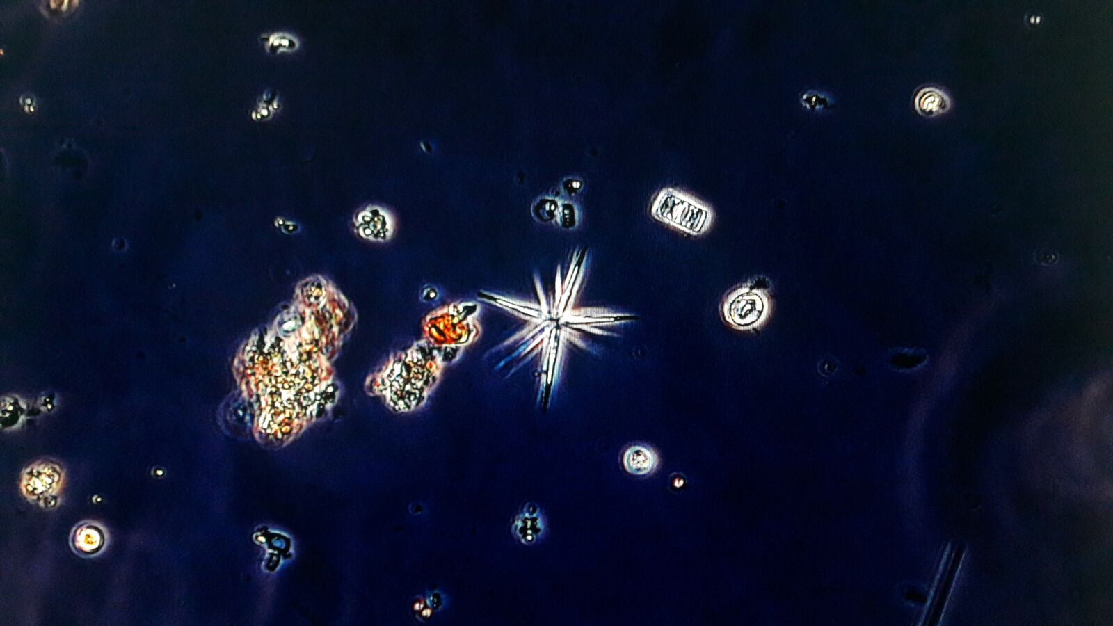 Samsung Galaxy A30 sample photo. Algae, phytoplankton, needle photography