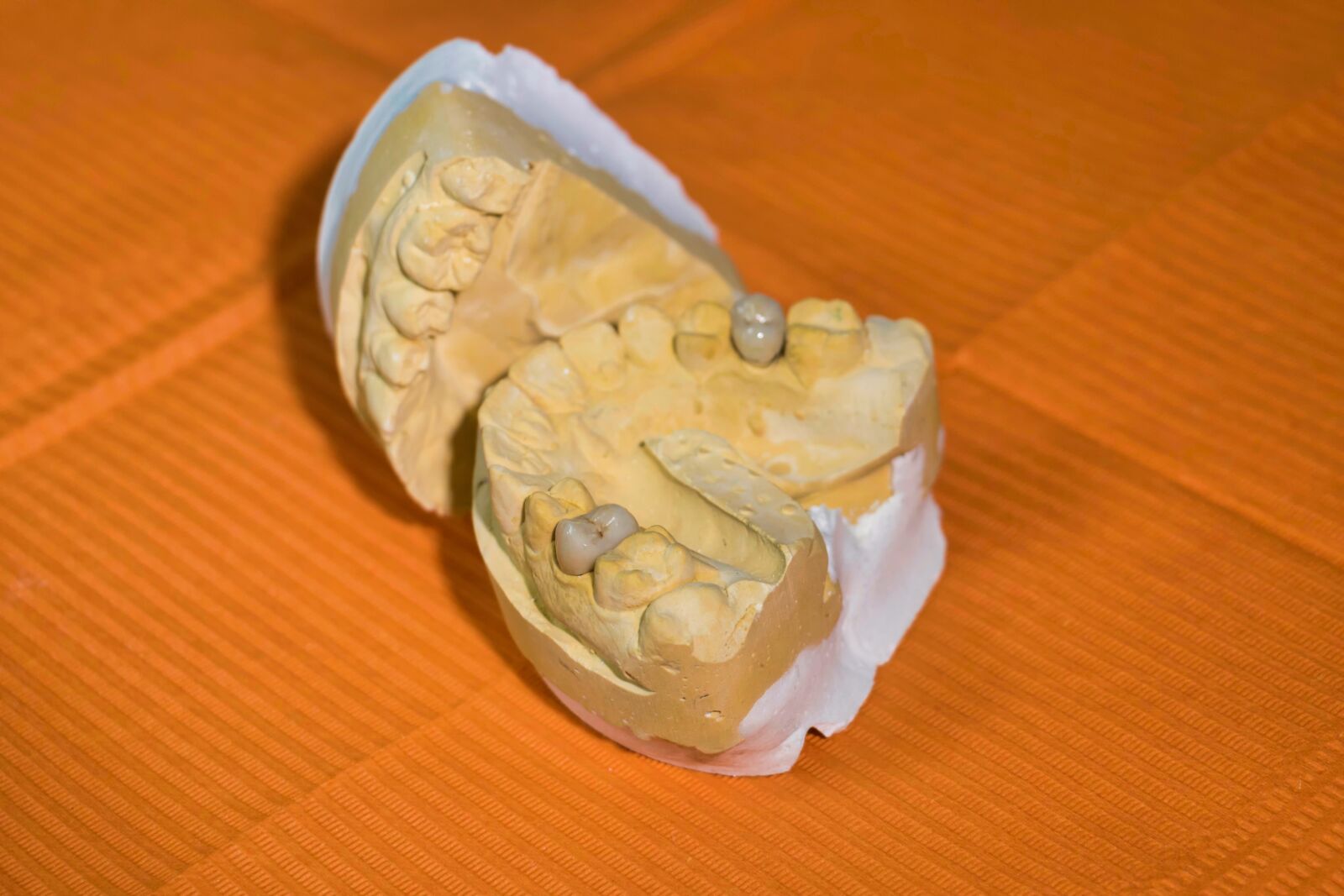 Canon EOS 7D Mark II sample photo. Mold, dental, dentist photography