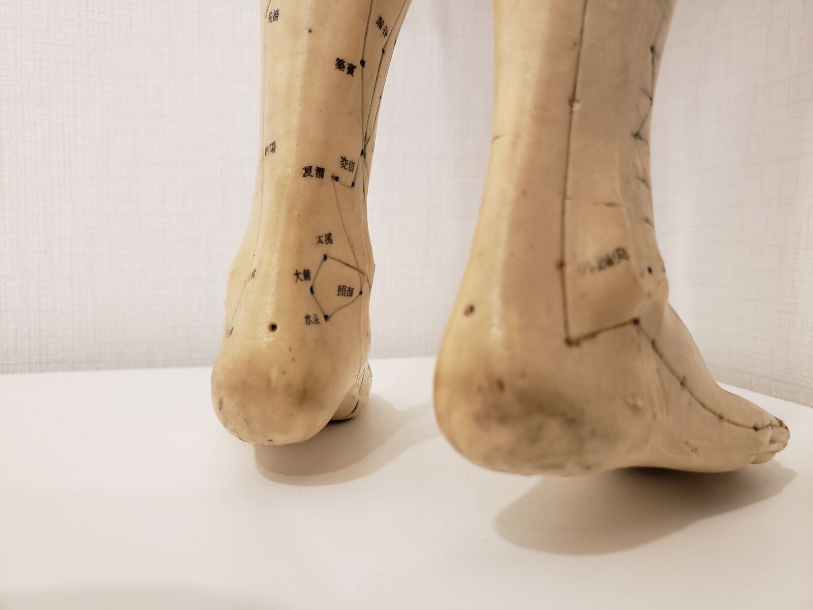 Samsung Galaxy S9 sample photo. Body, acupuncture, needle photography