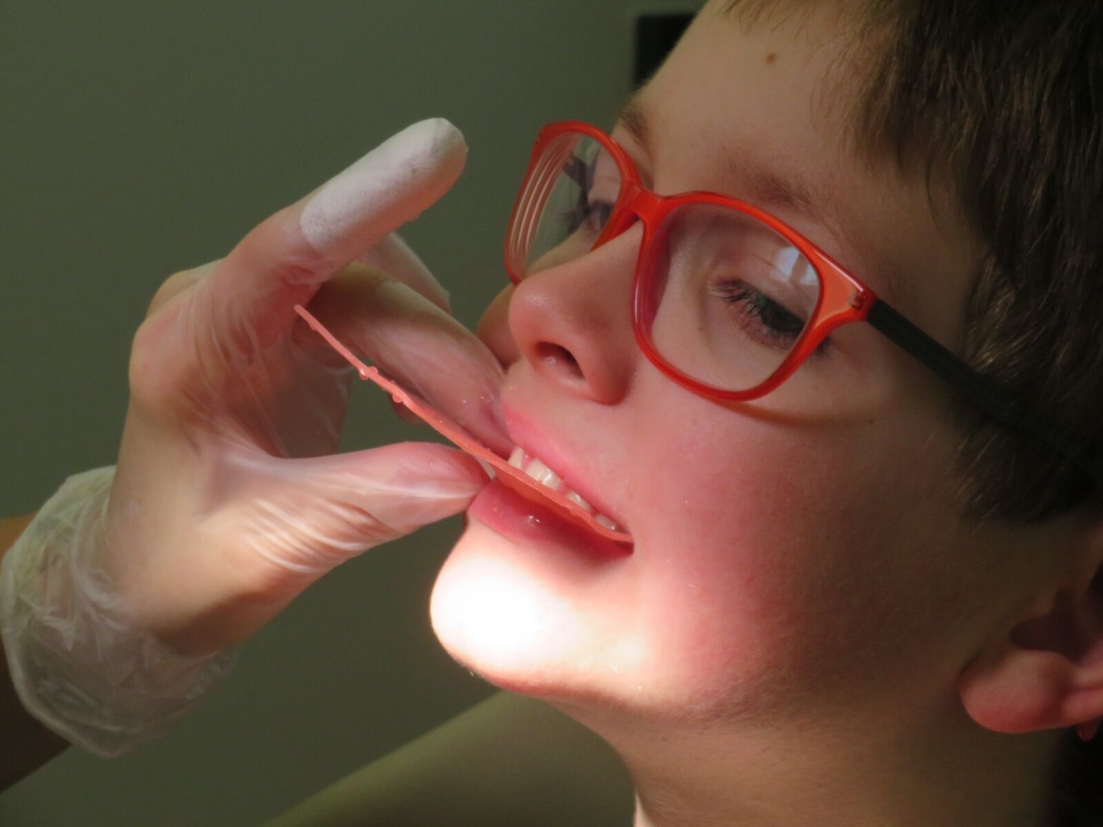 Canon PowerShot SX720 HS sample photo. Child, dentist, teeth photography