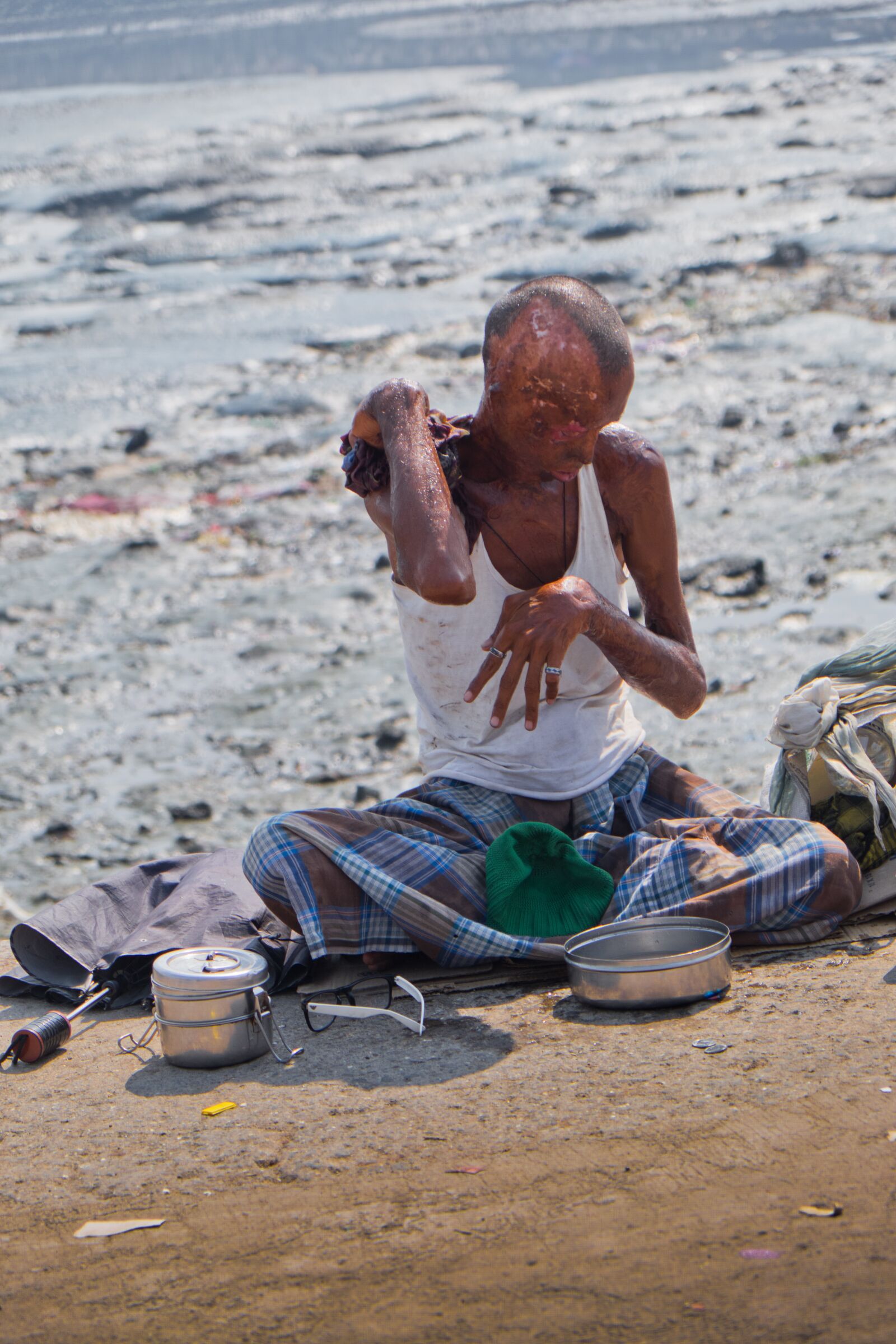 Fujifilm X-E2 sample photo. Disabled, burned skin, poverty photography