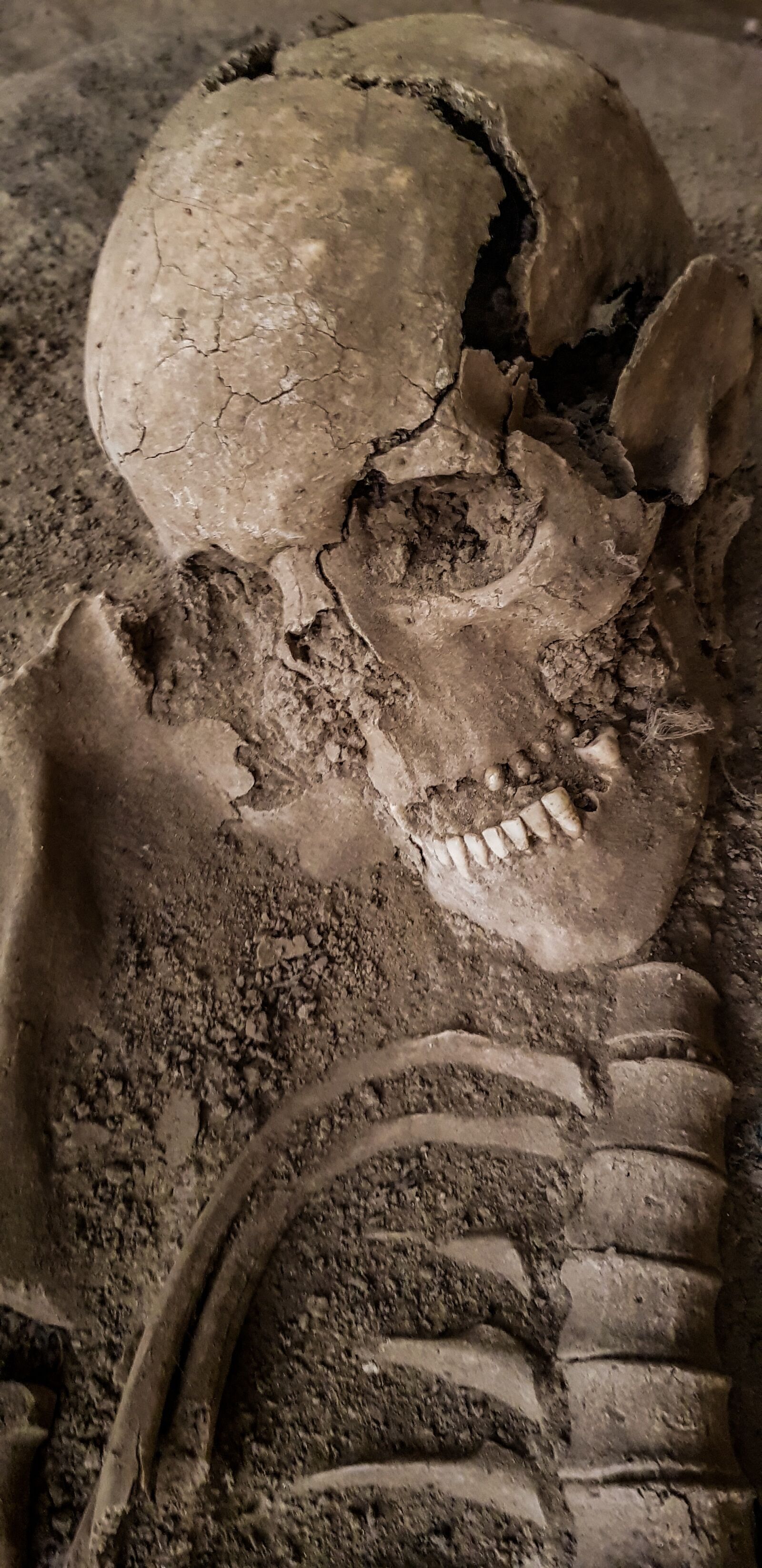 Samsung Galaxy S8+ Rear Camera sample photo. Archaeology, skull, skeleton photography