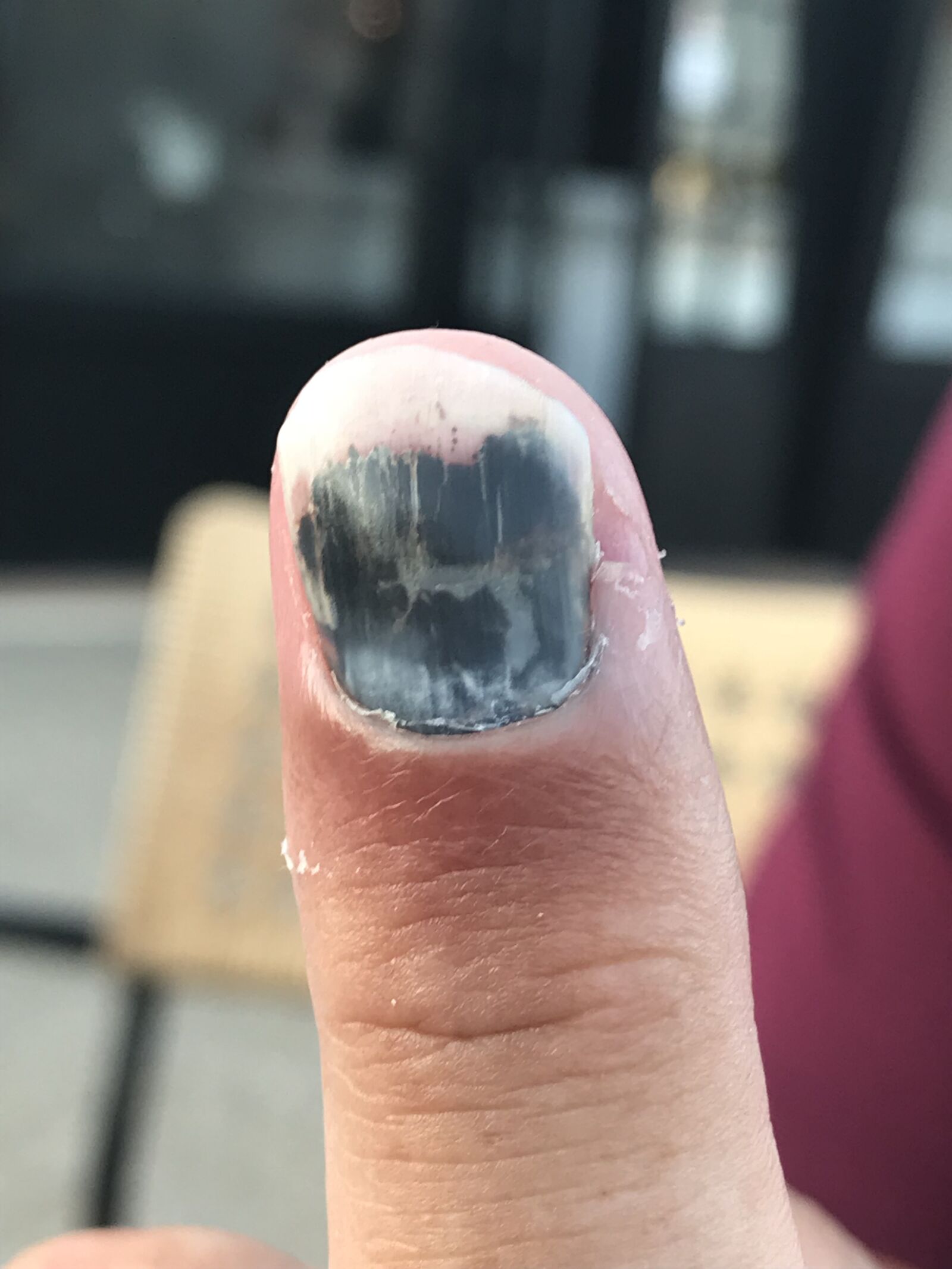 iPhone 7 back camera 3.99mm f/1.8 sample photo. Bruise, number, weird photography
