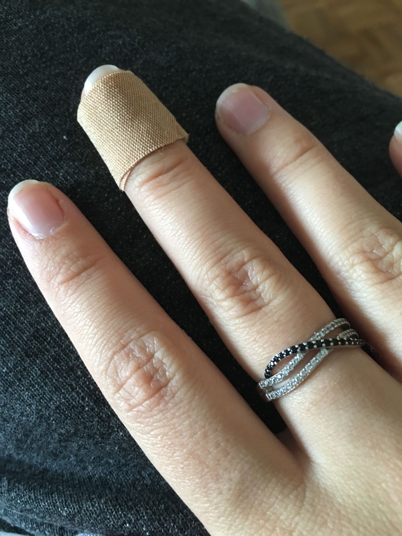 Apple iPhone 6s Plus sample photo. Hand, fingers, wound photography