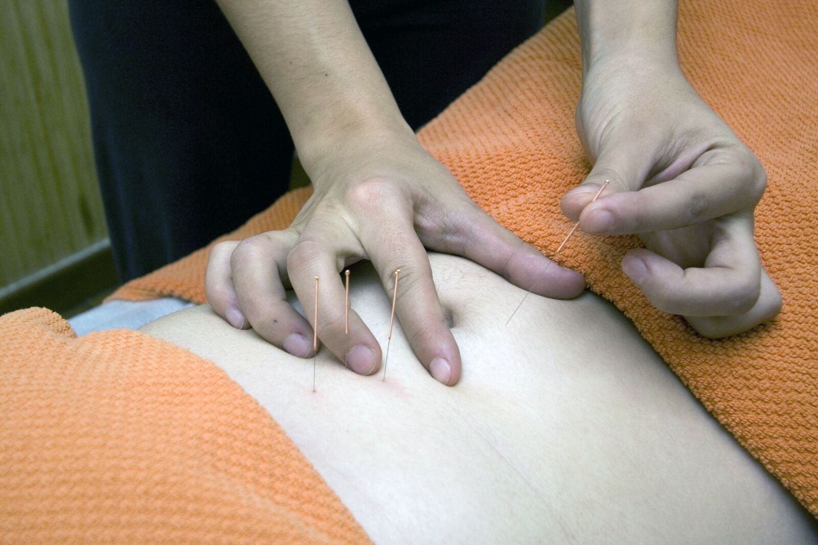 Canon EOS 450D (EOS Rebel XSi / EOS Kiss X2) sample photo. Acupuncture, physiotherapy, wellness photography