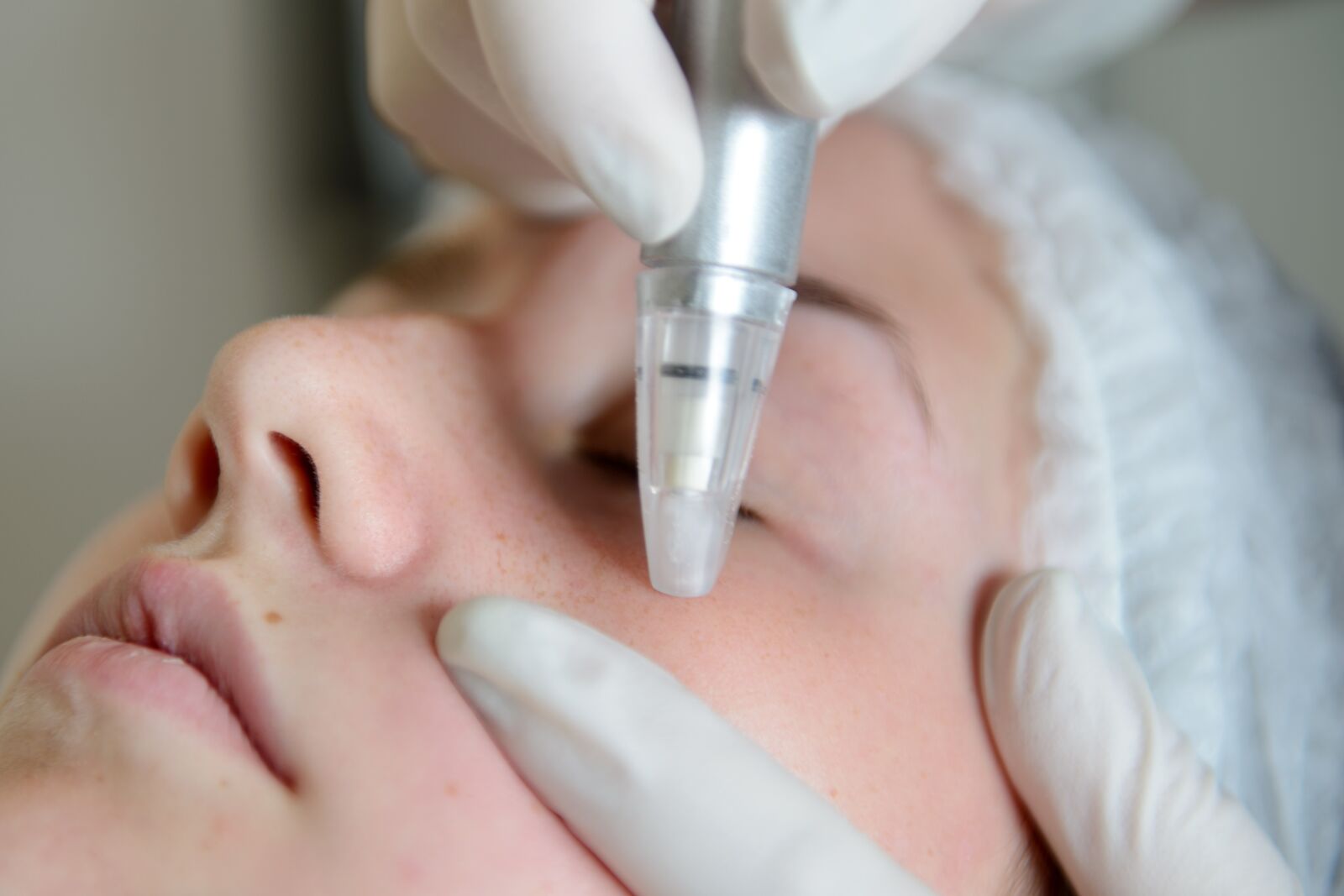 Nikon D800E sample photo. Woman, microdermabrasion, skin improvement photography