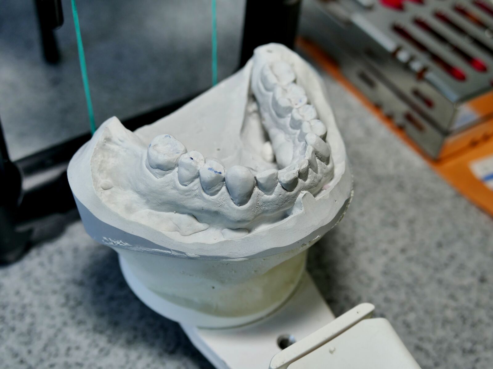 Panasonic Lumix DMC-FZ1000 sample photo. Dental model, pine, tooth photography