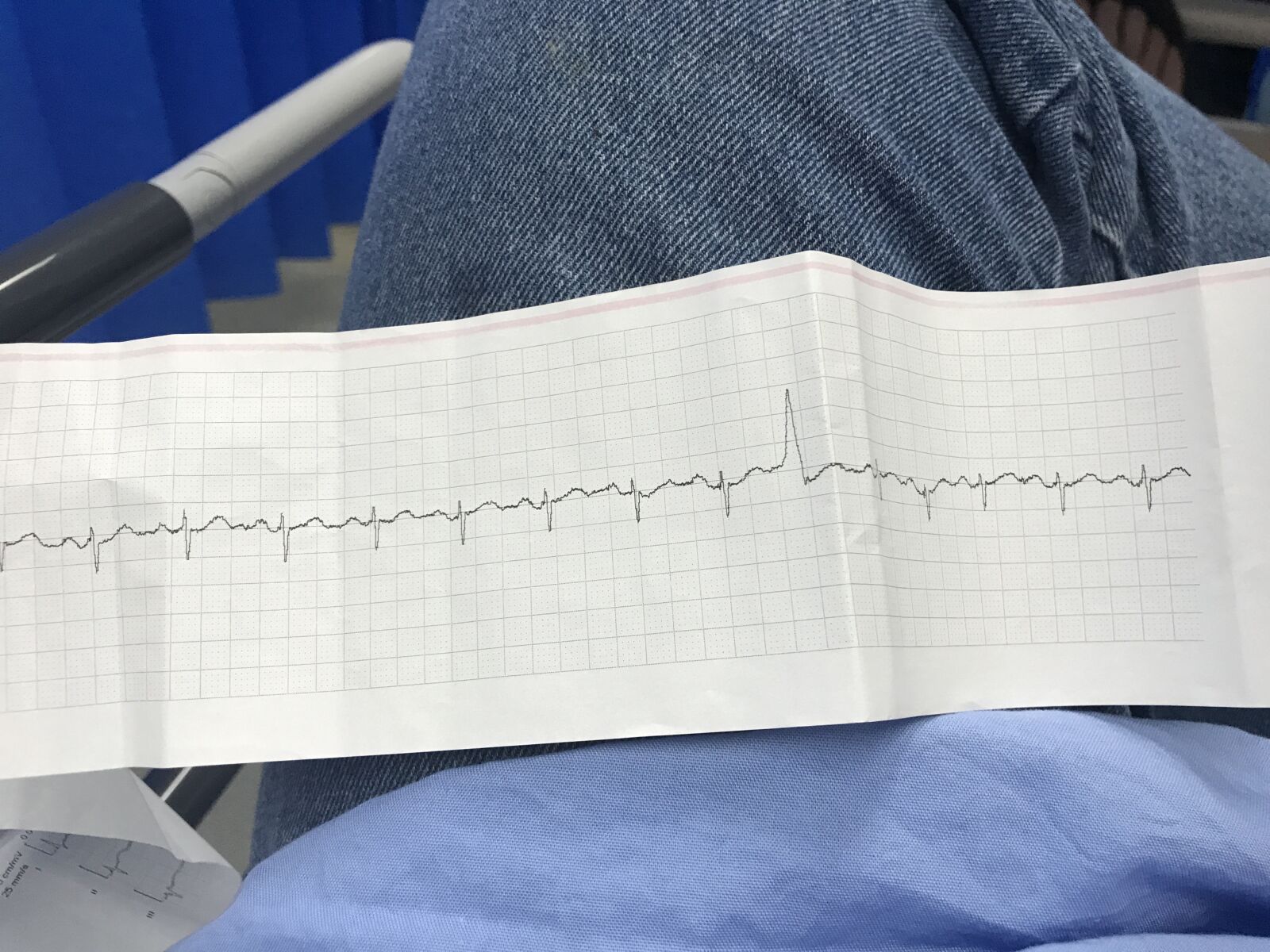 iPhone 7 back camera 3.99mm f/1.8 sample photo. Arrhythmia, cardiac, ecg, electrocardiogram photography