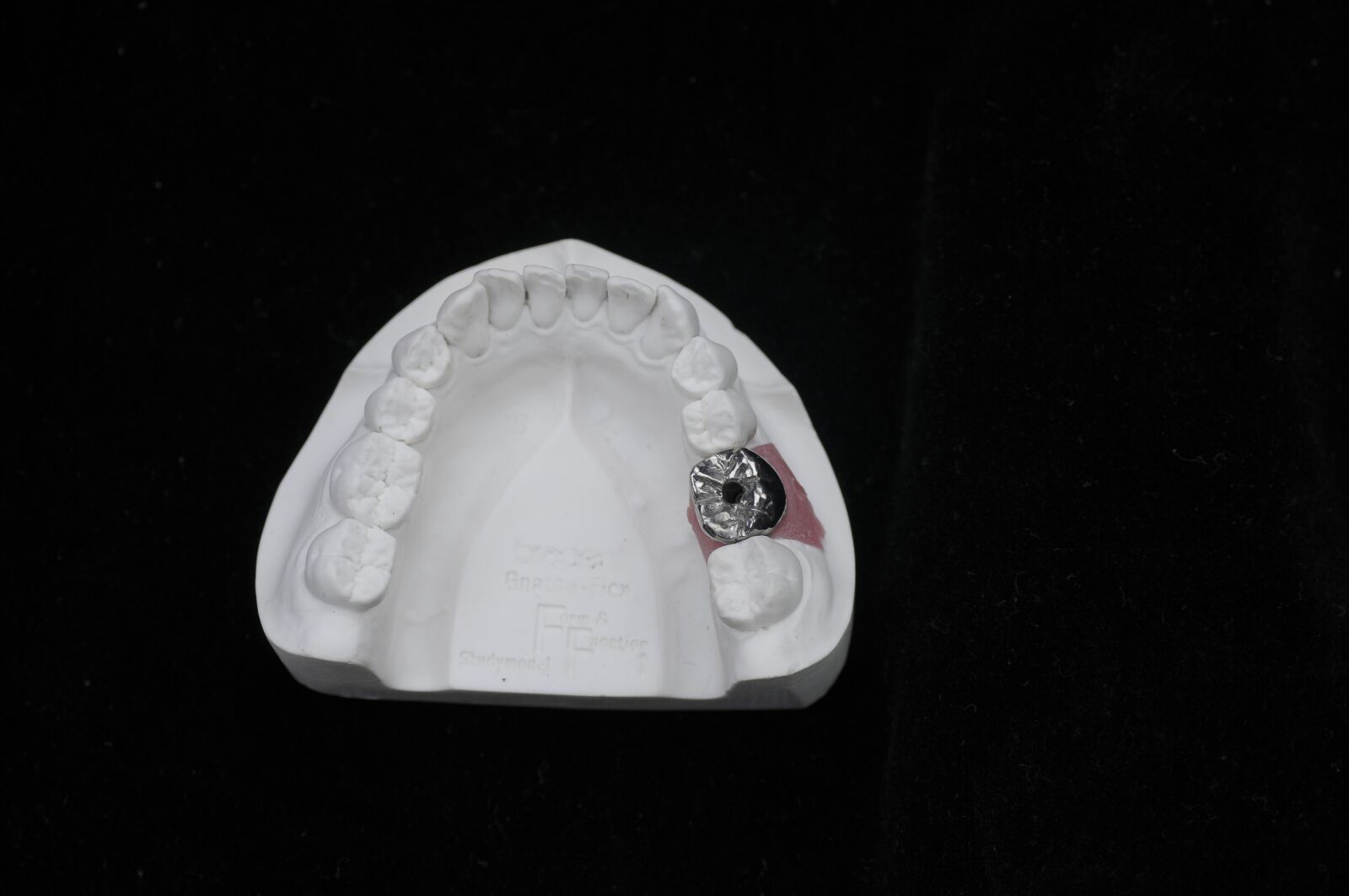 Nikon D300 sample photo. Teeth, gypsum photography