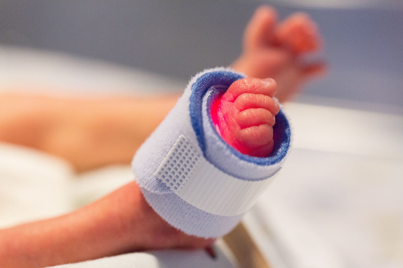 Canon EF 100mm F2.8L Macro IS USM sample photo. Foot, preemie, child photography