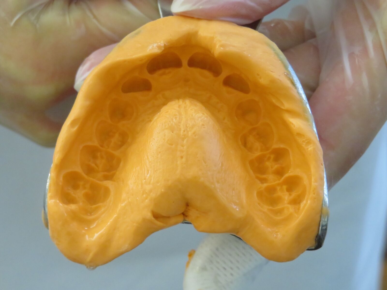 Canon PowerShot SX720 HS sample photo. Teeth, bitten, dentist photography