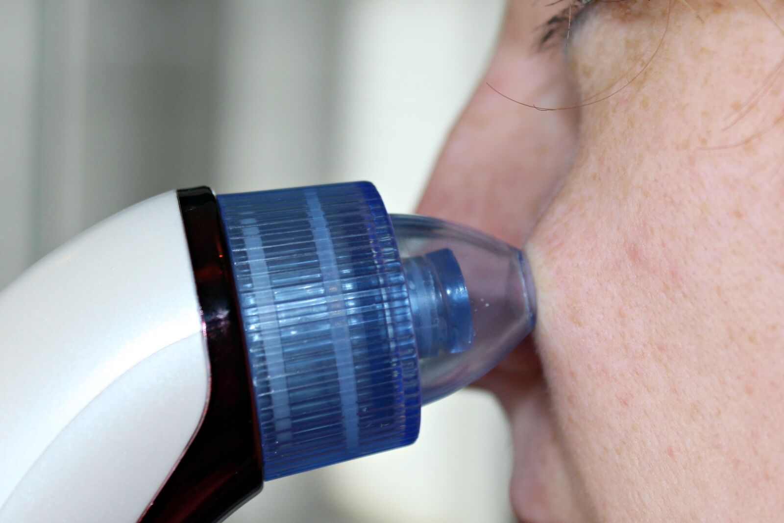Canon EOS 650D (EOS Rebel T4i / EOS Kiss X6i) sample photo. Blackheads, blackhead remover, pimples photography