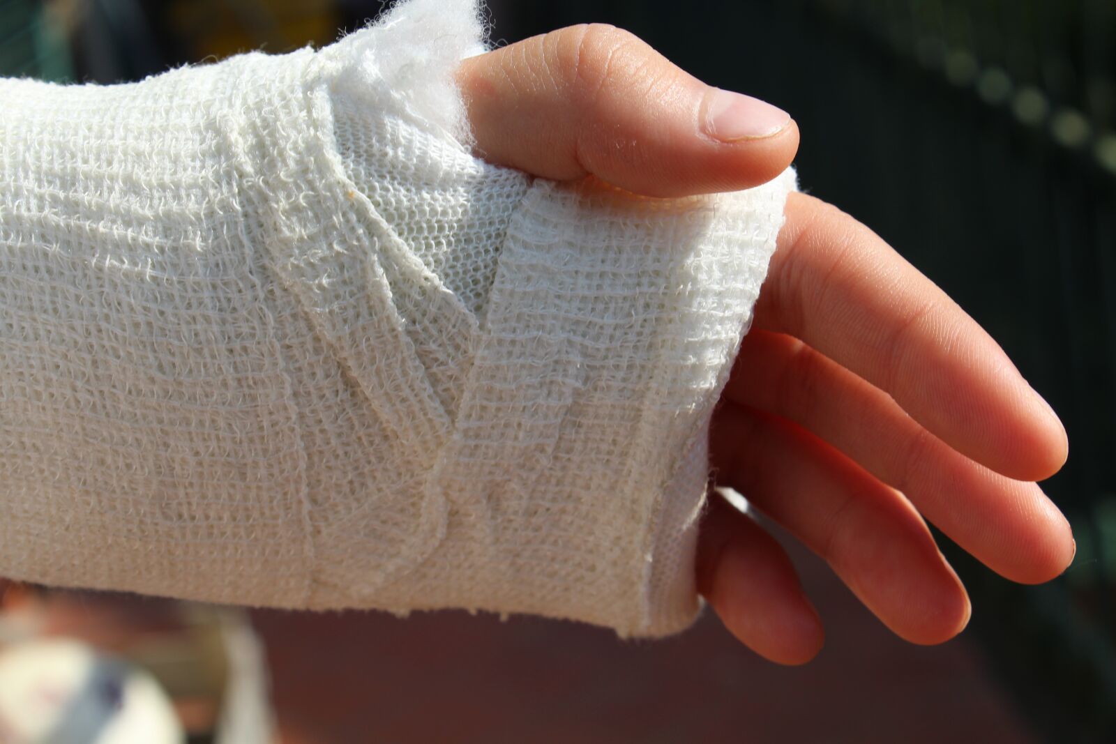 Canon EOS 1200D (EOS Rebel T5 / EOS Kiss X70 / EOS Hi) sample photo. Orthopedics, bandage, hand photography