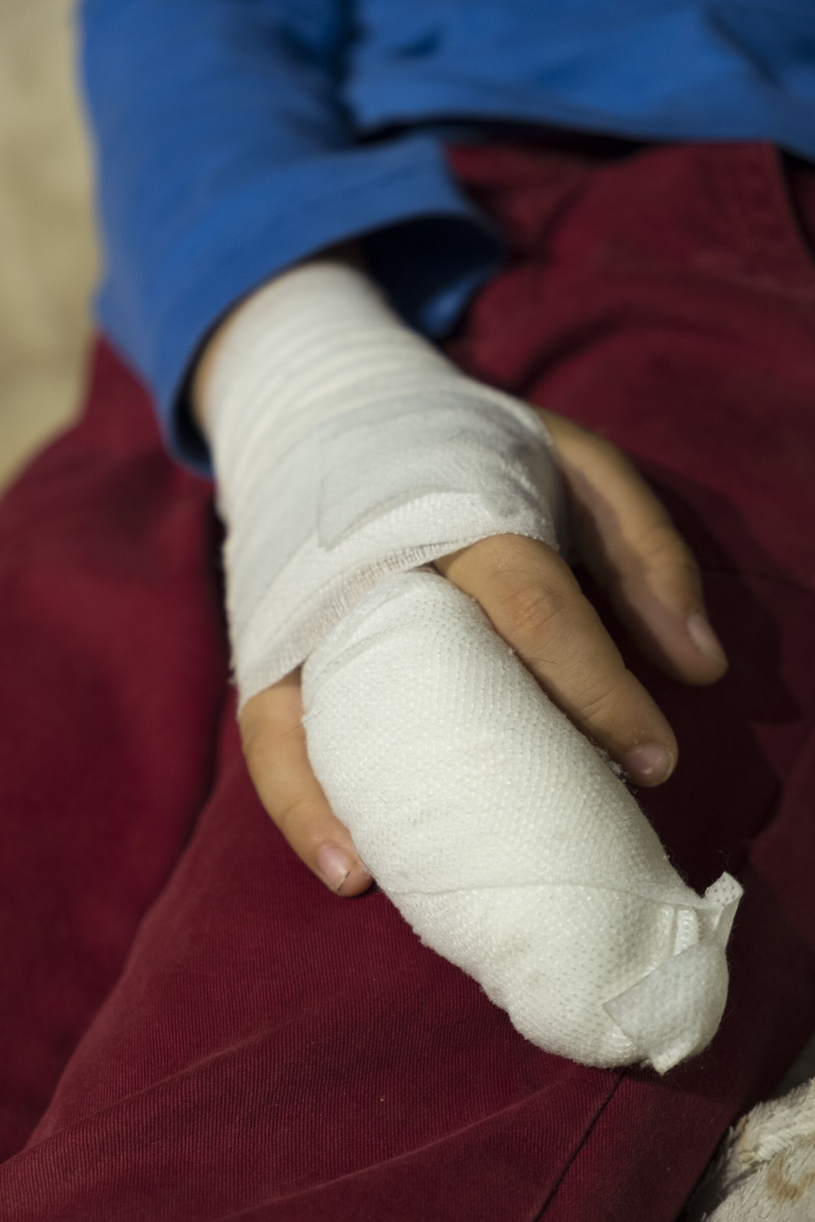 Fujifilm XF 18-55mm F2.8-4 R LM OIS sample photo. Child, boy, injury photography
